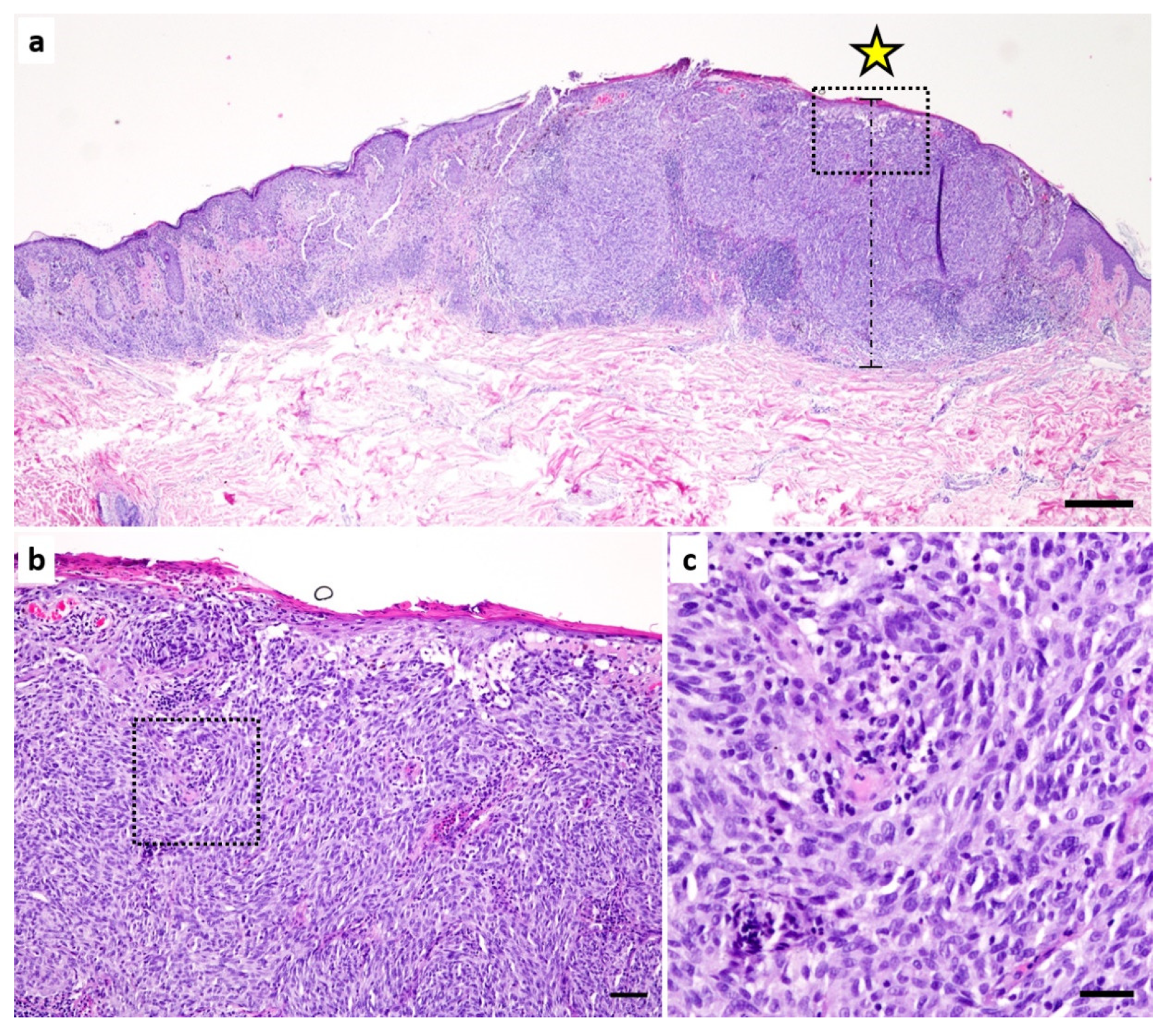 Cancers 14 02243 g001 550