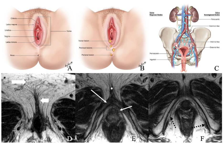 Cancers 14 02264 g001 550