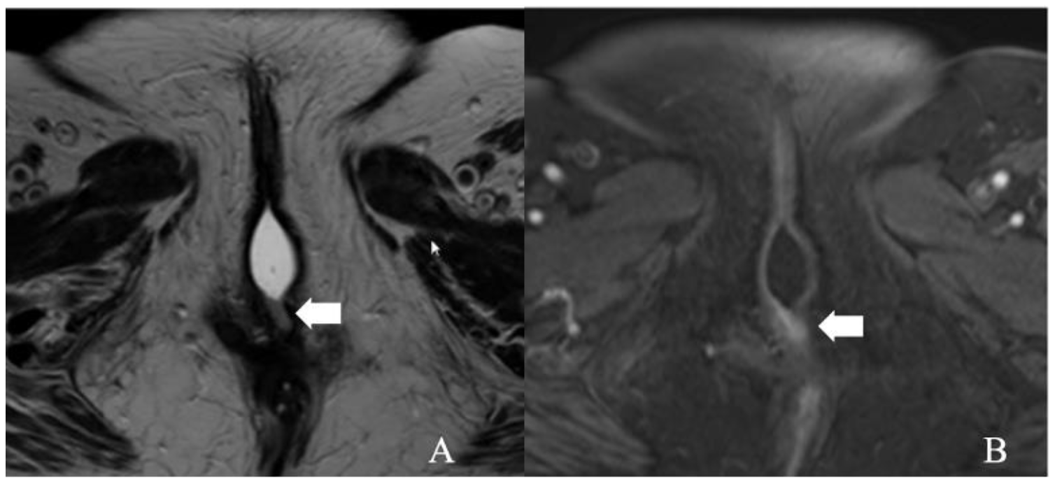 Cancers 14 02264 g003 550