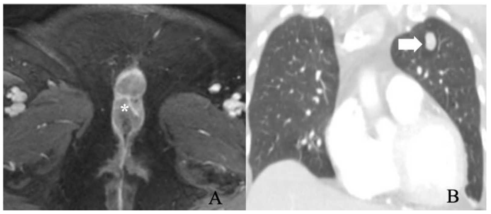 Cancers 14 02264 g007 550