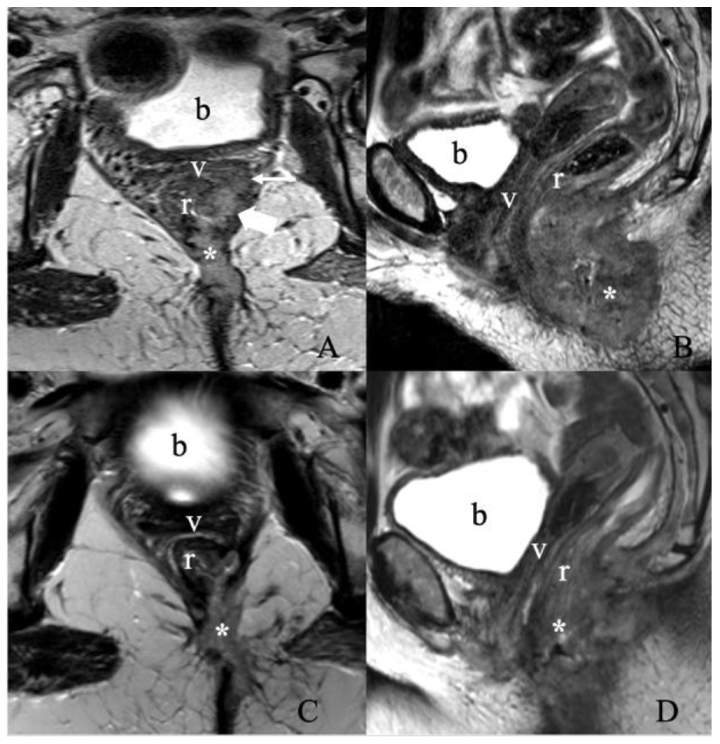 Cancers 14 02264 g011 550