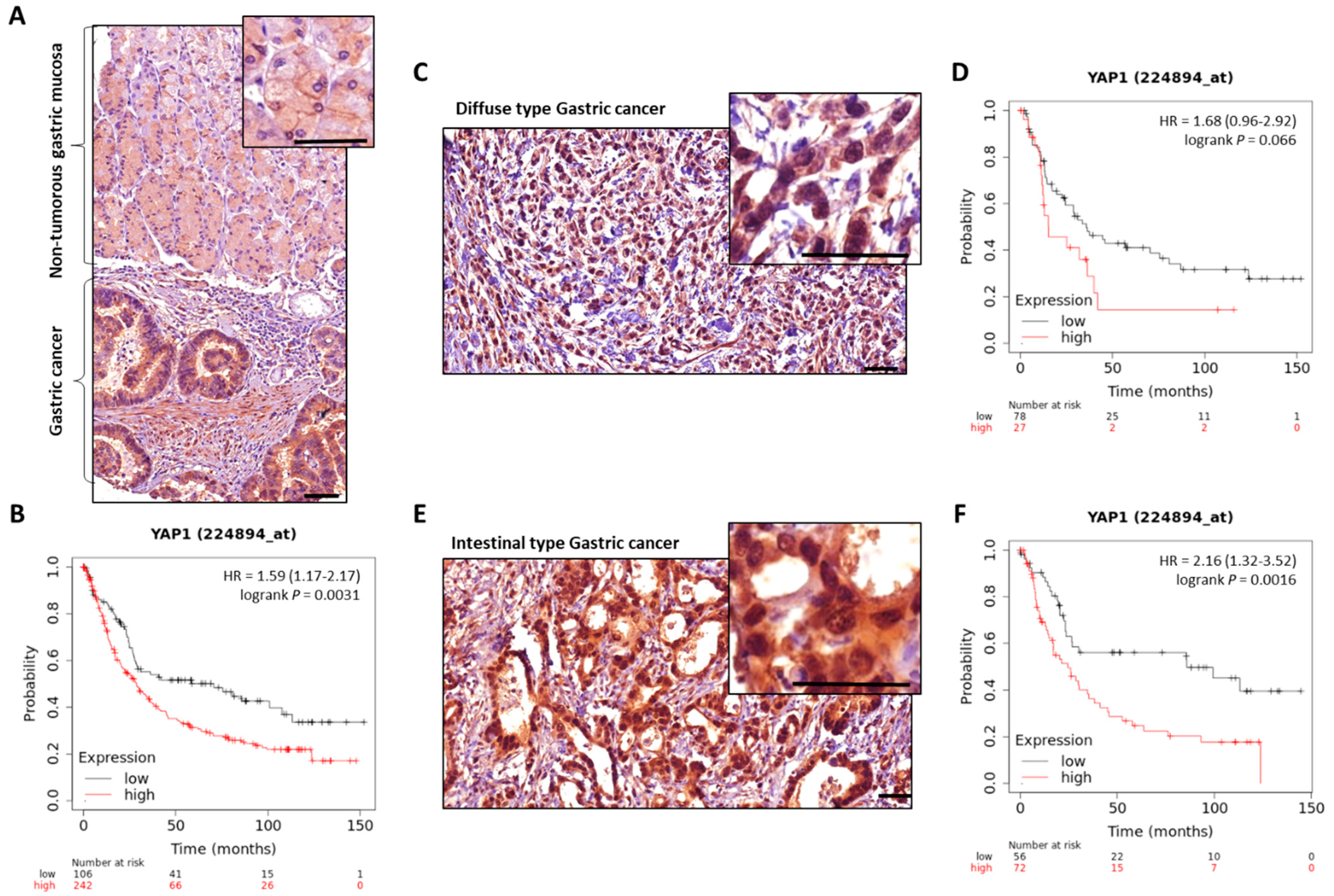 Cancers 14 02282 g003 550