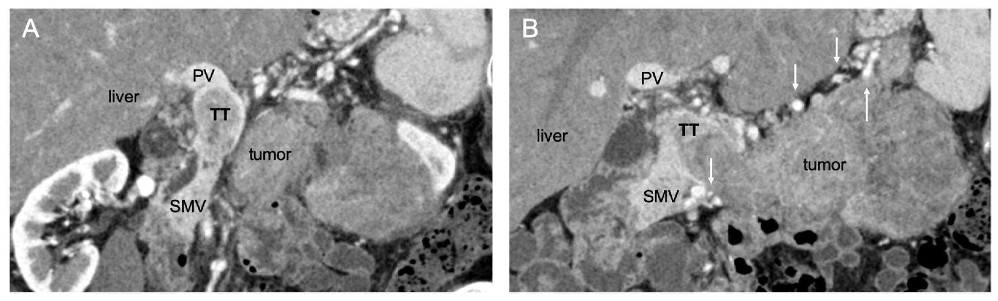 Cancers 14 02312 g002