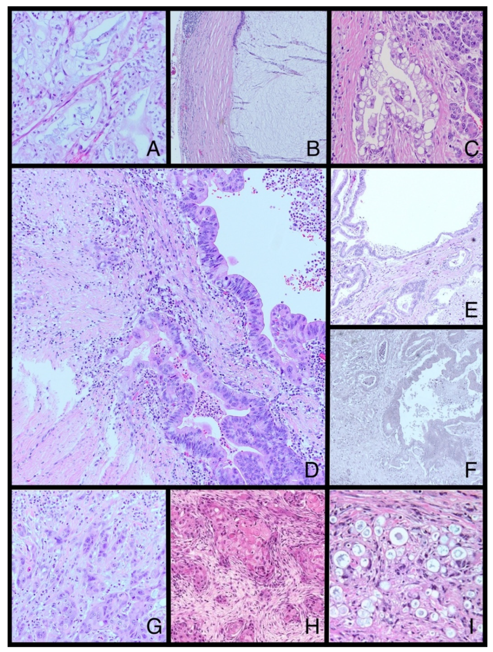 Cancers 14 02321 g002