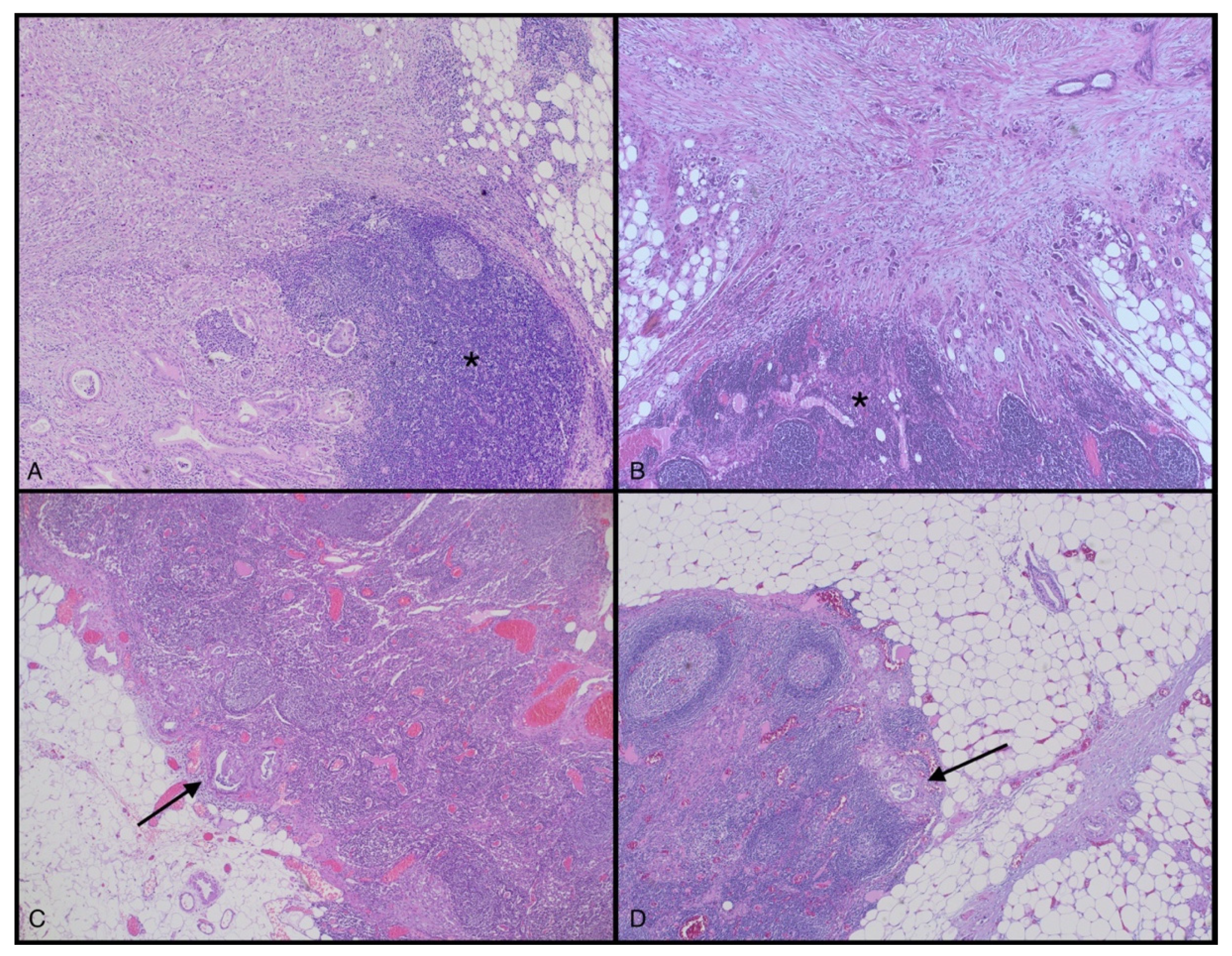 Cancers 14 02321 g004