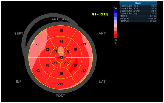 Baseline global longitudinal strain bull's-eye plot of the 16
