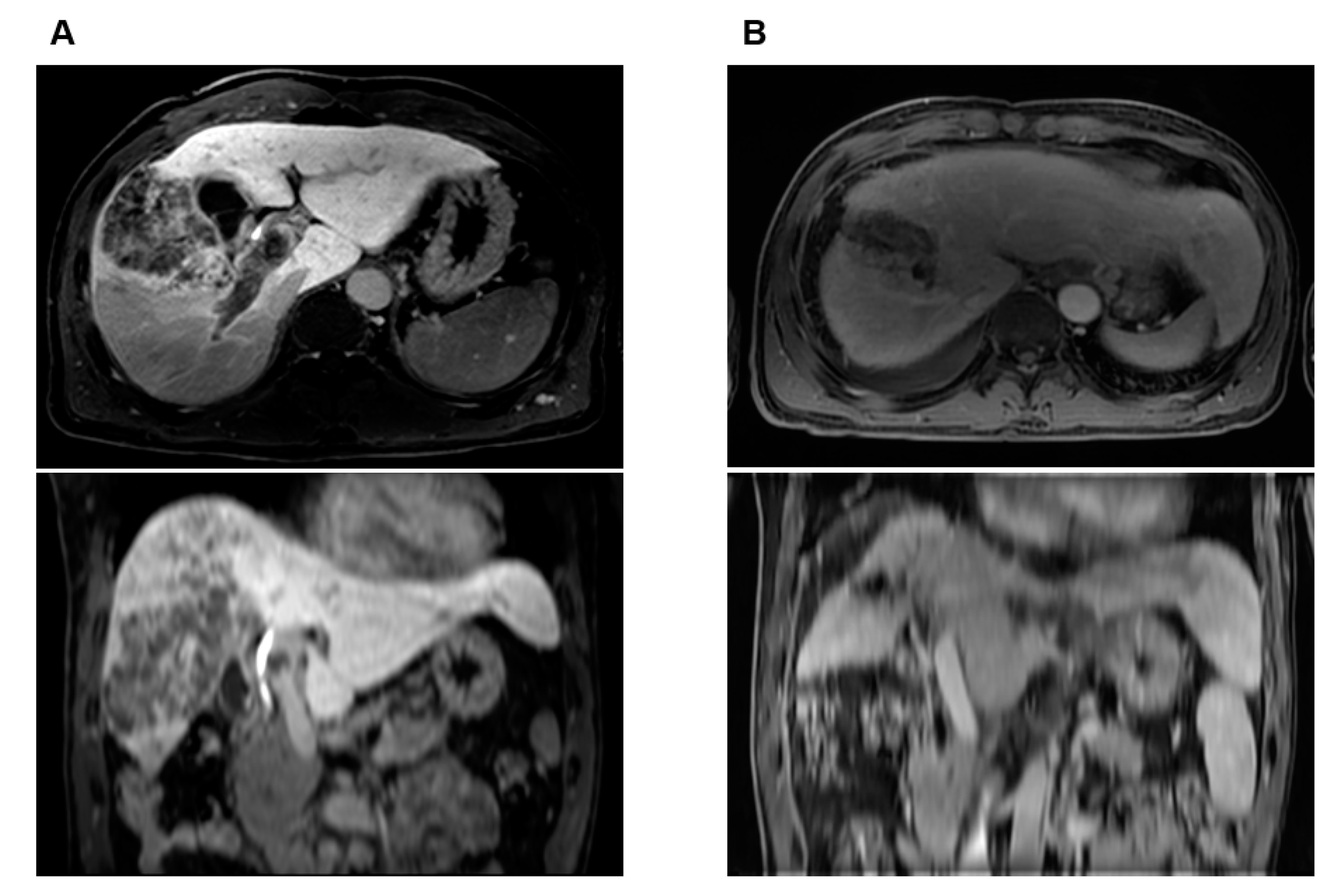 Cancers 14 02396 g005 Cancers 14 02396 g005