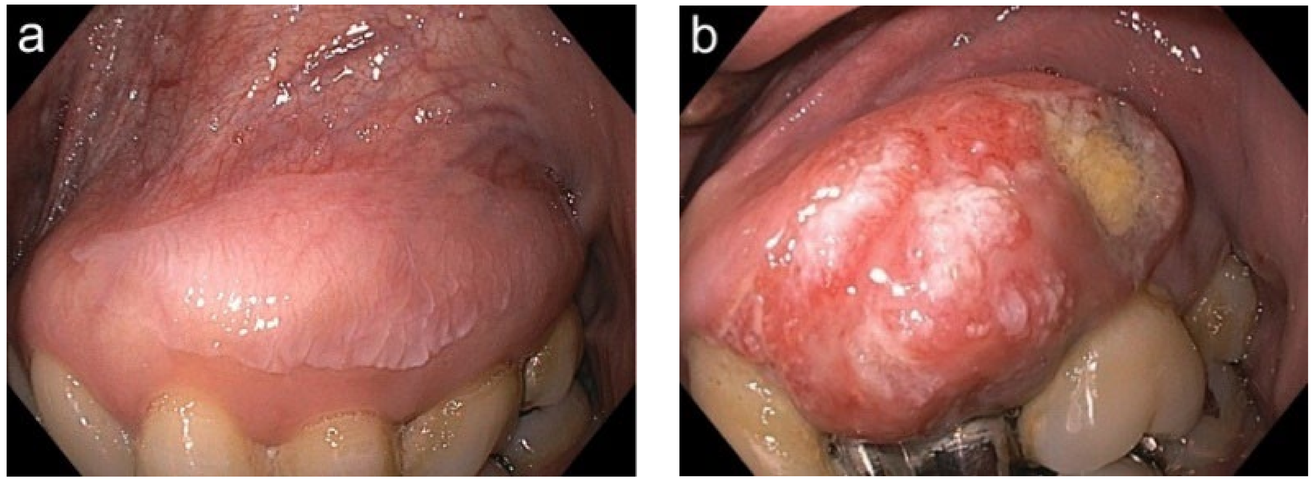 Cancers 14 02415 g003 550