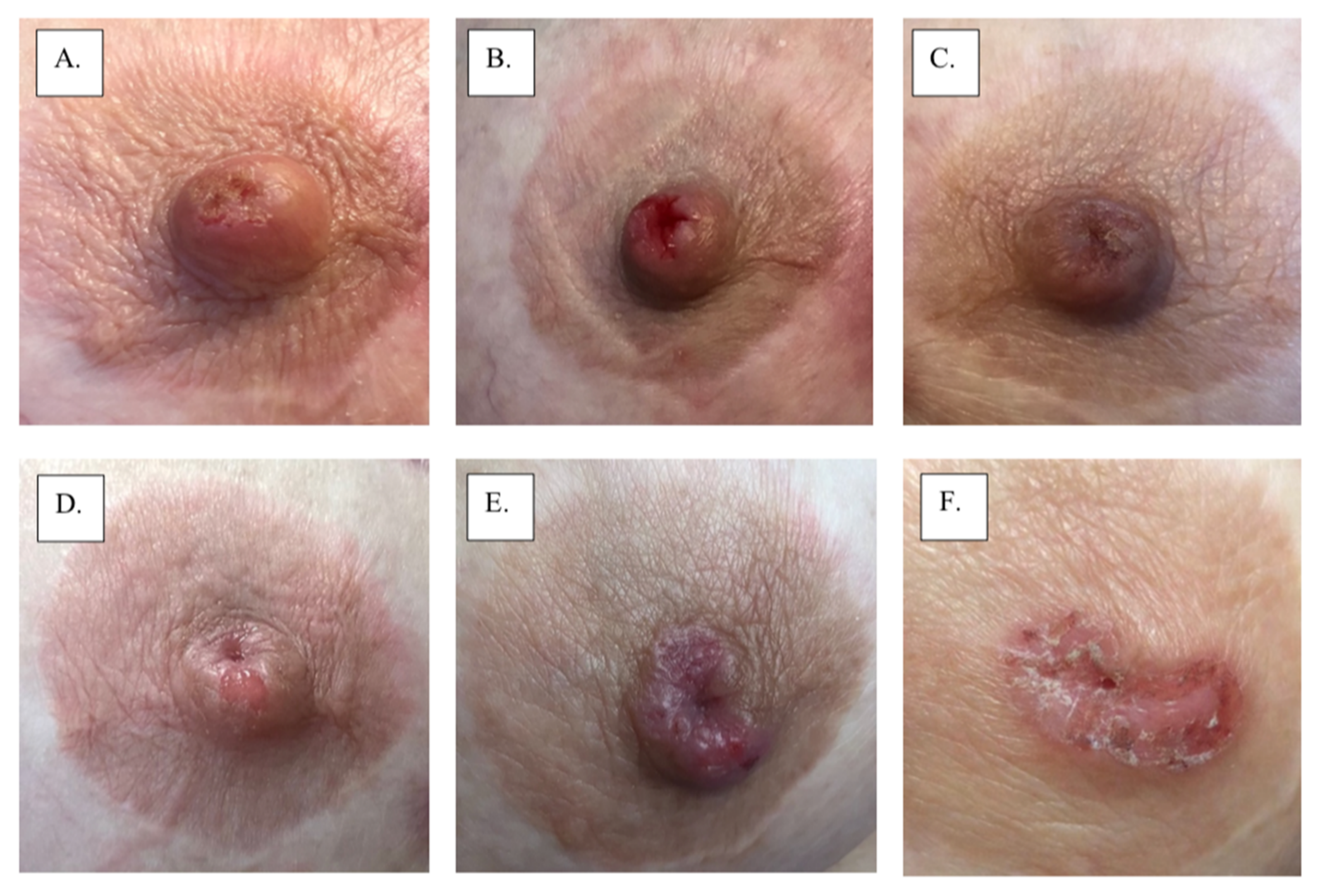 Cancers 14 02422 g002