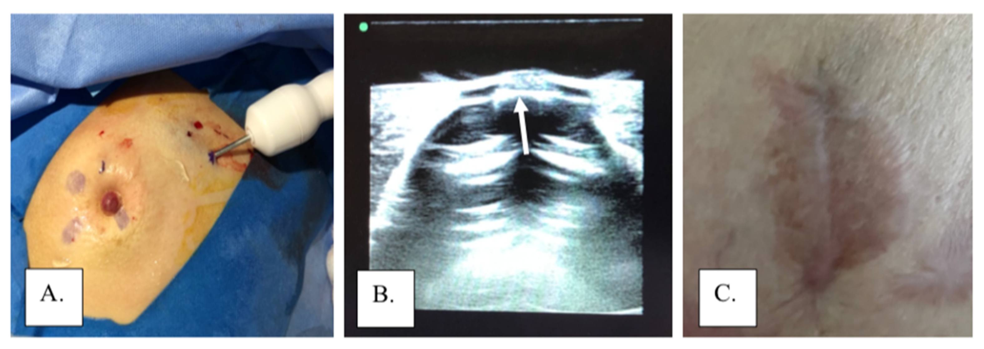 Cancers 14 02422 g005