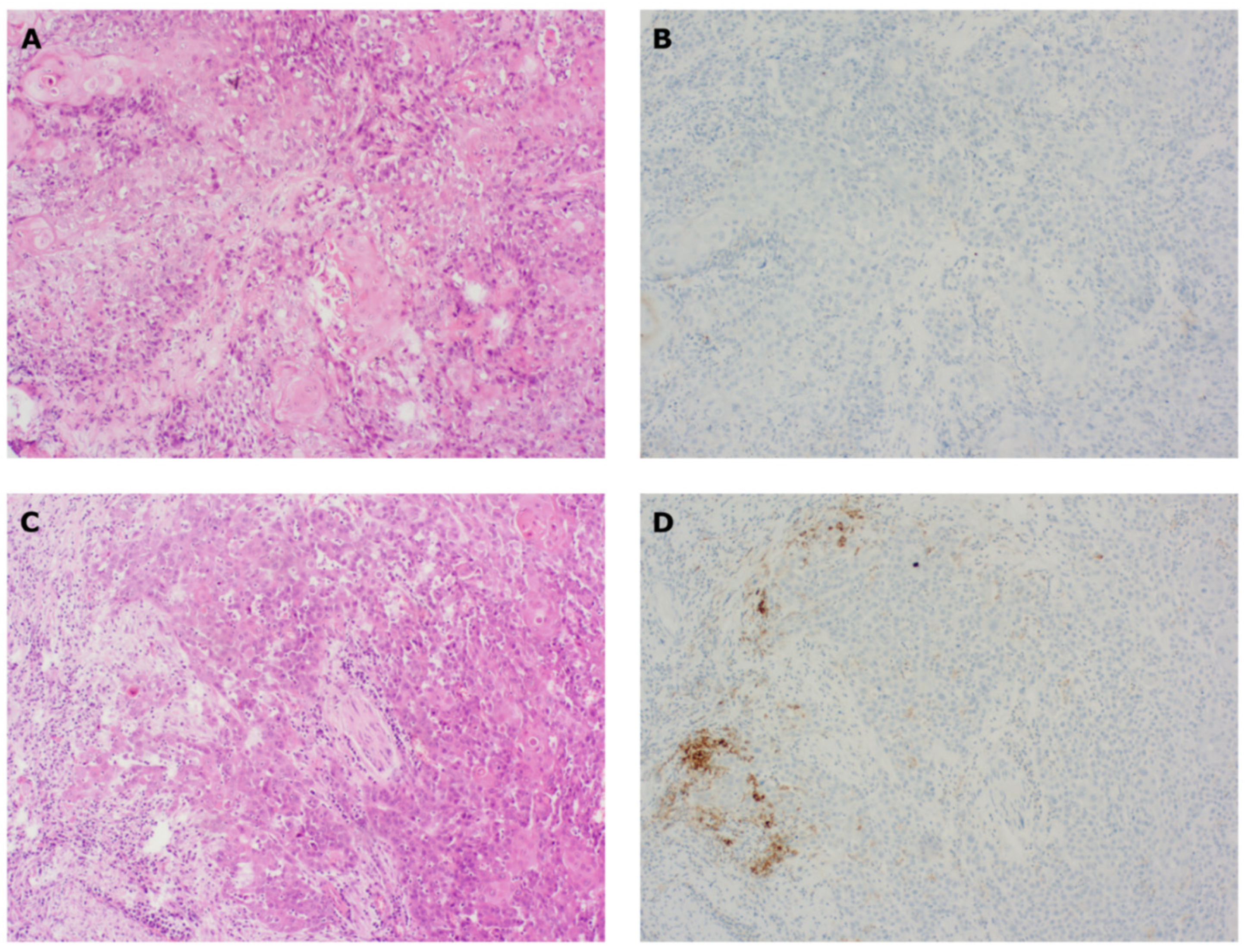 Cancers 14 02431 g001