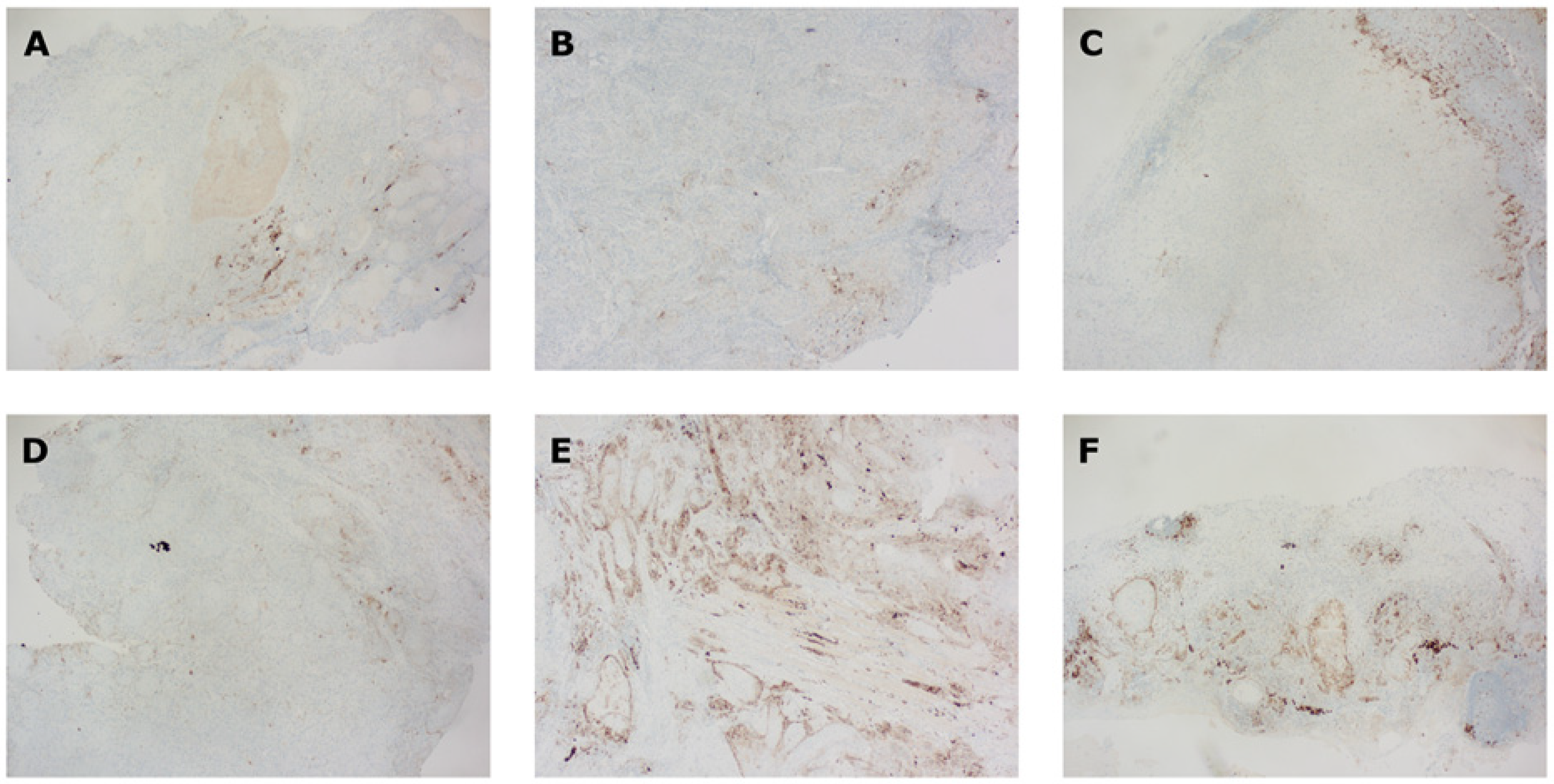 Cancers 14 02431 g002