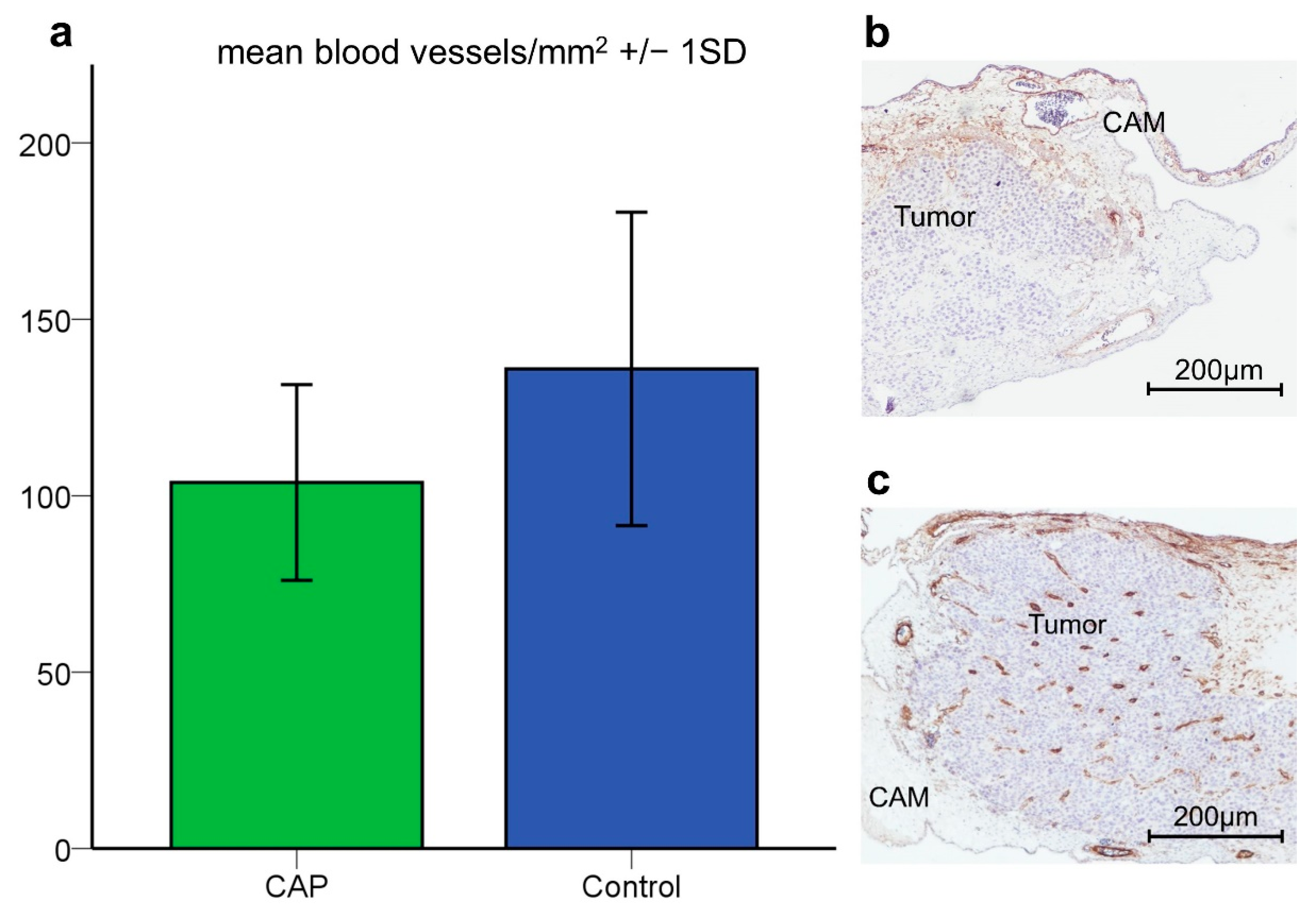 Cancers 14 02432 g002 Cancers 14 02432 g002