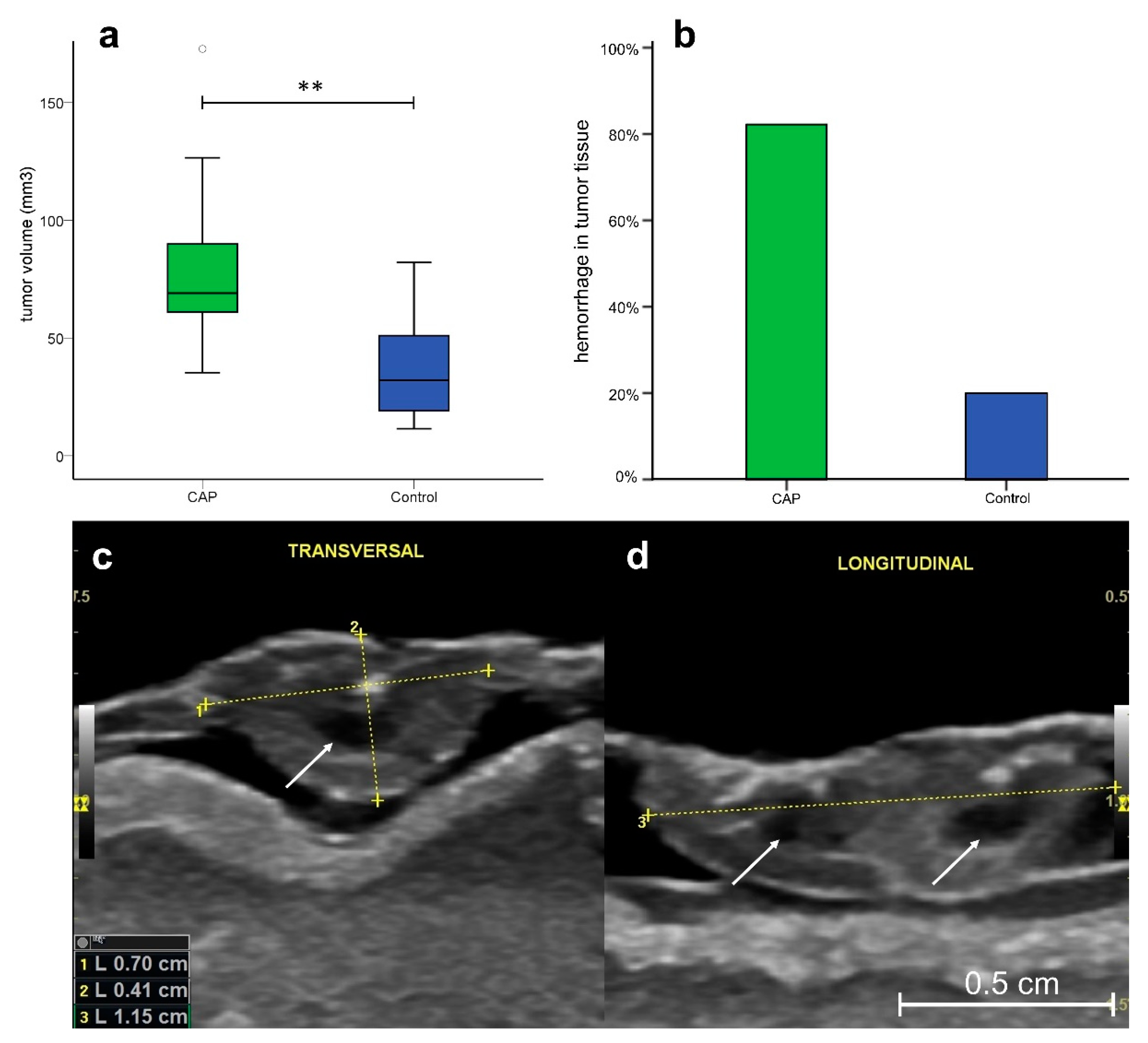 Cancers 14 02432 g005 Cancers 14 02432 g005