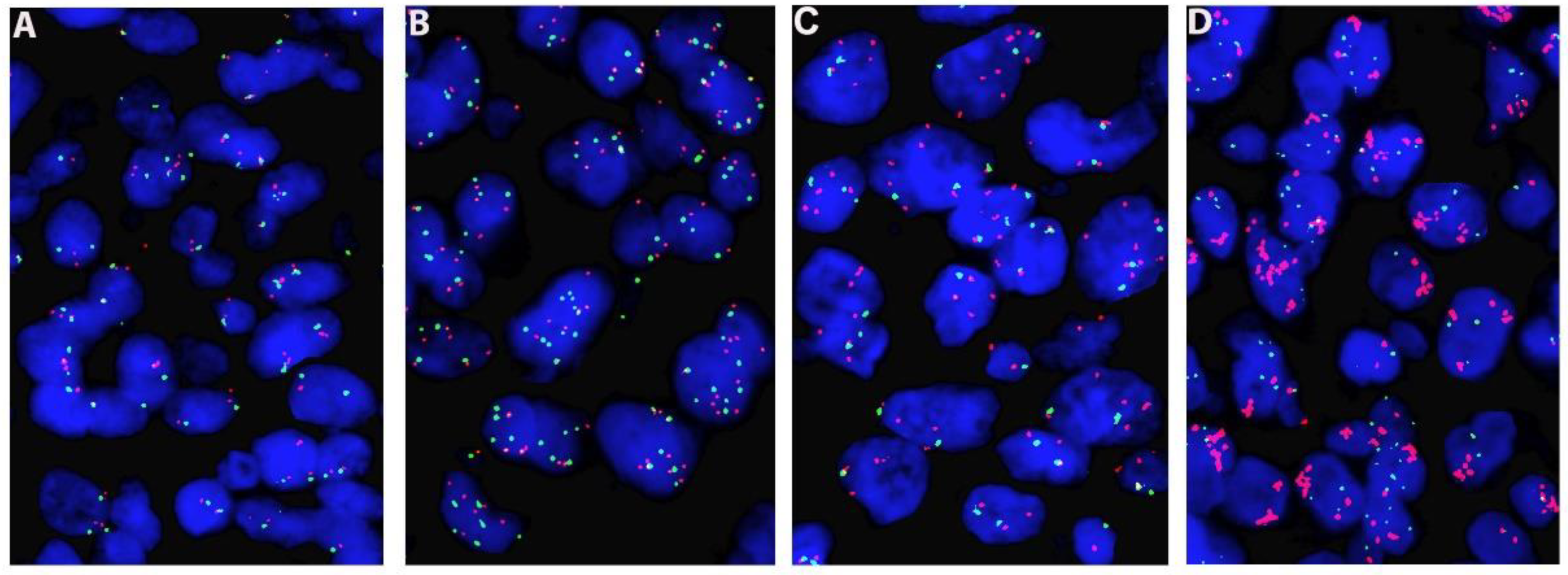 Cancers 14 02433 g001