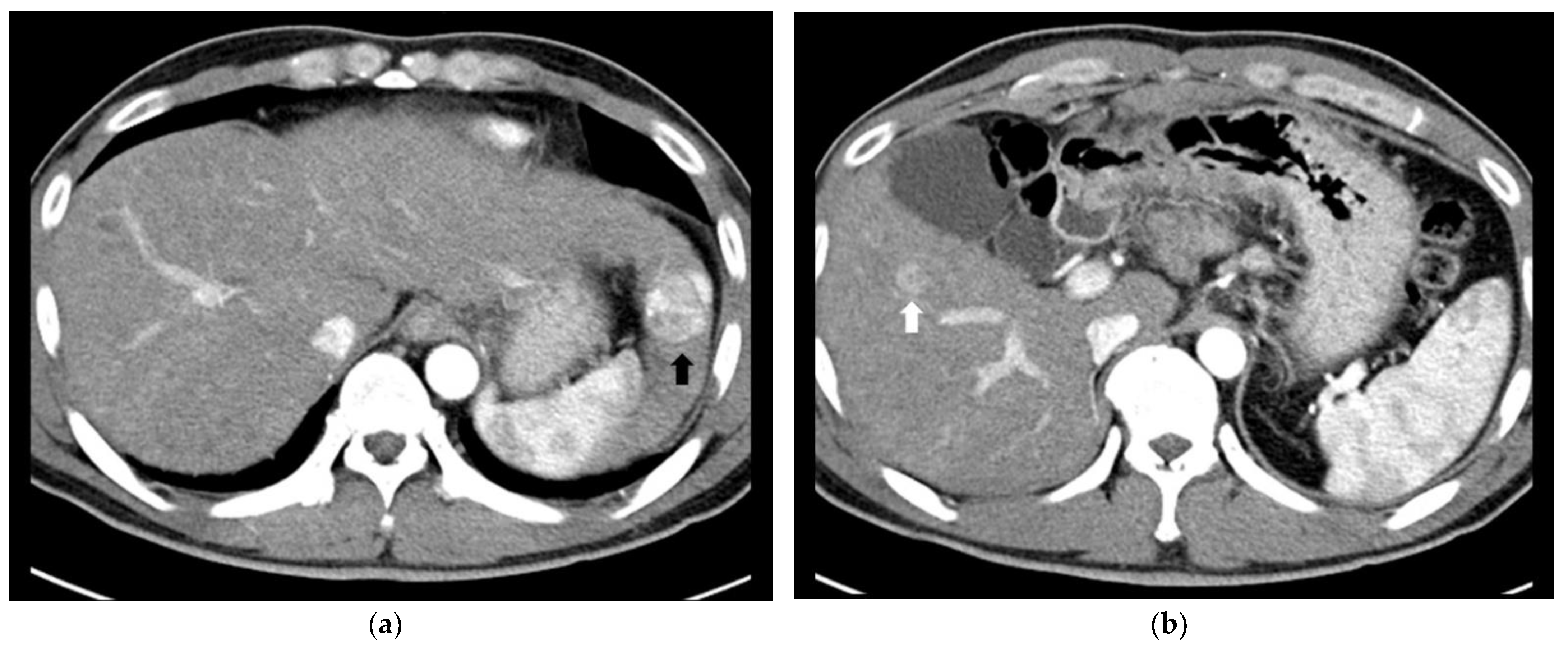 Cancers 14 02440 g003a 550