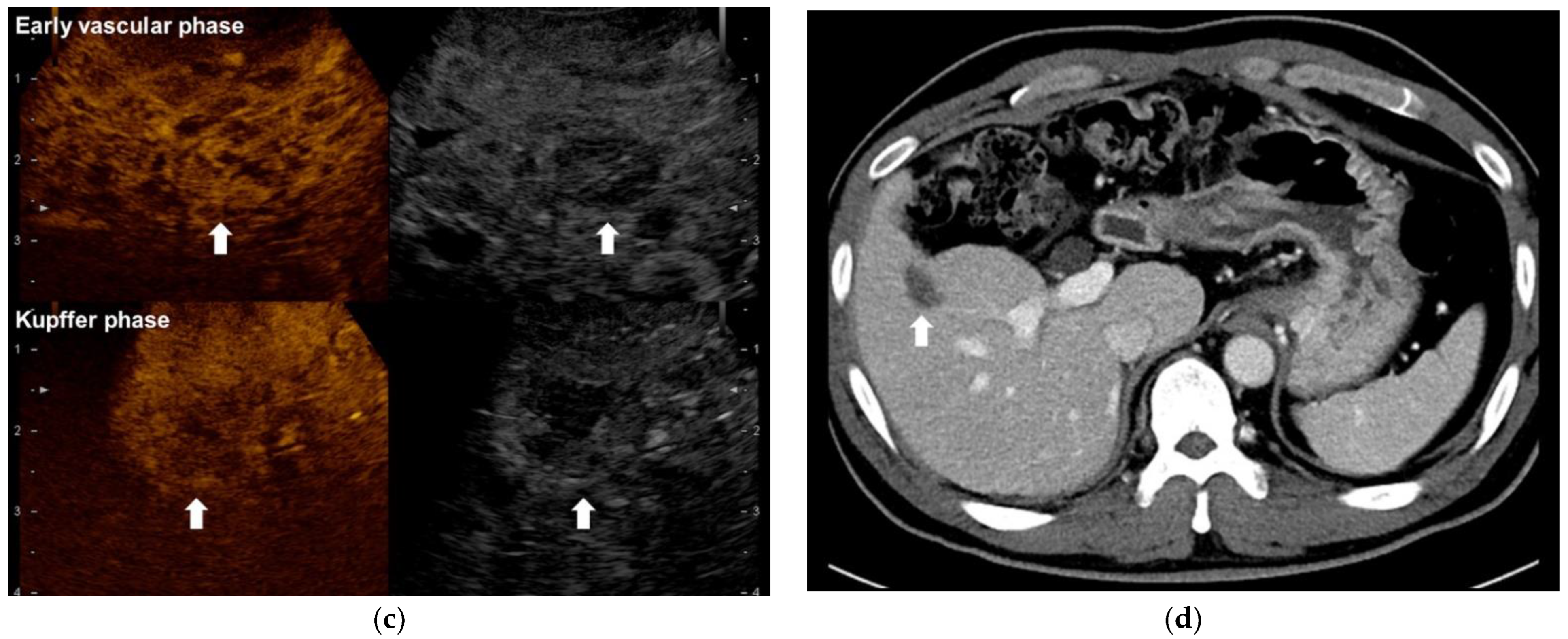 Cancers 14 02440 g003b 550