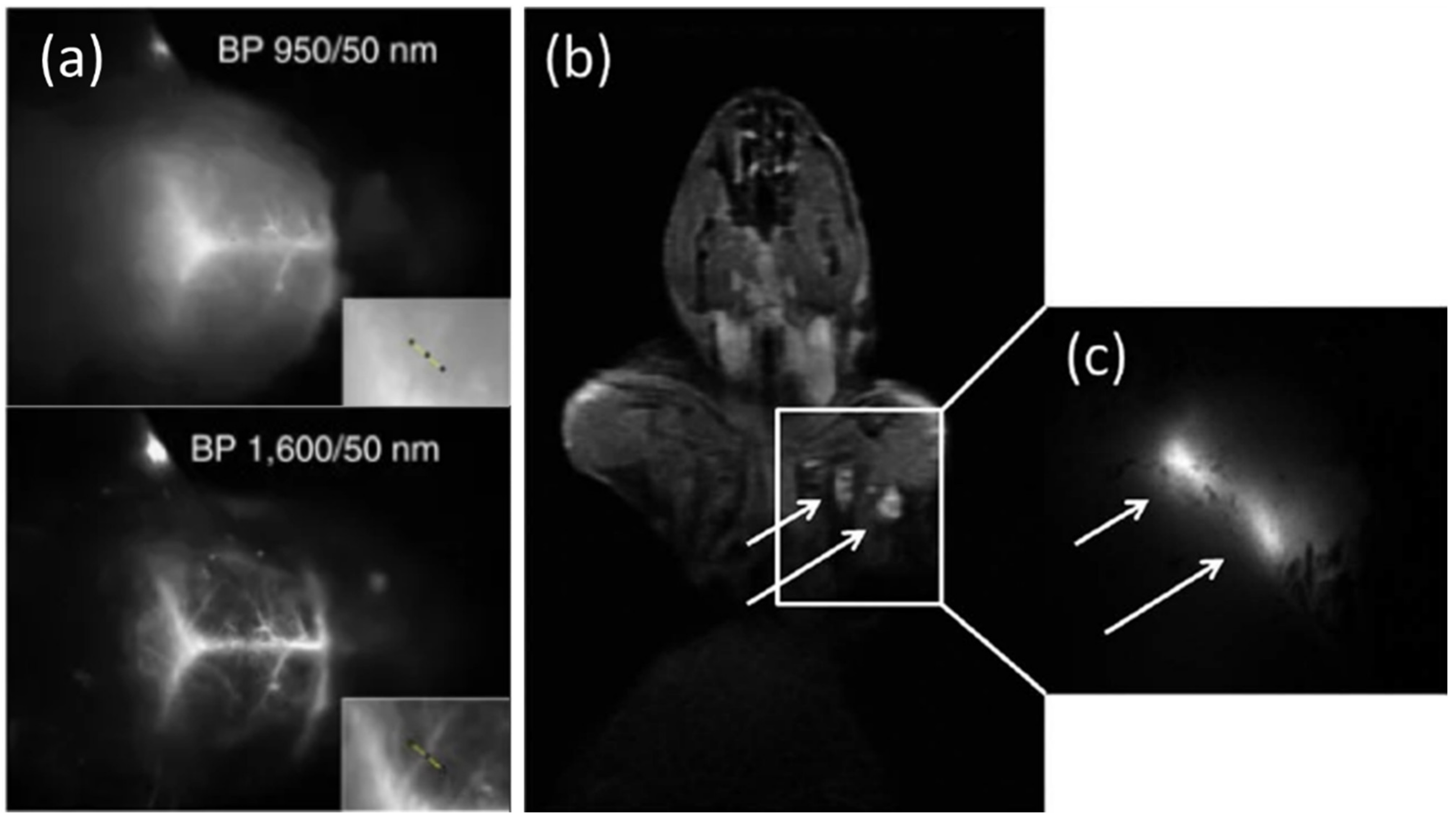 Cancers 14 02456 g003 550