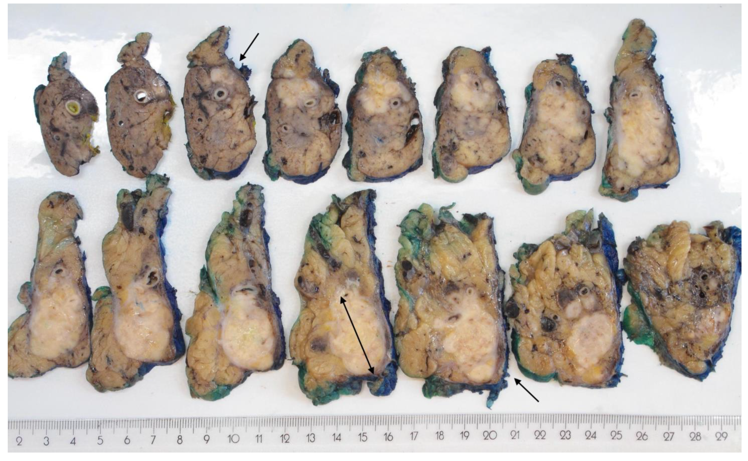 Cancers 14 02471 g003