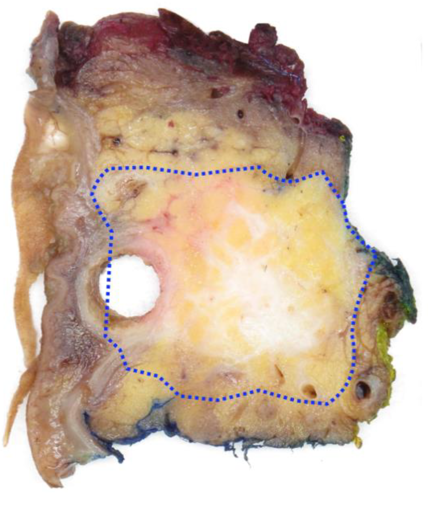 Cancers 14 02471 g004