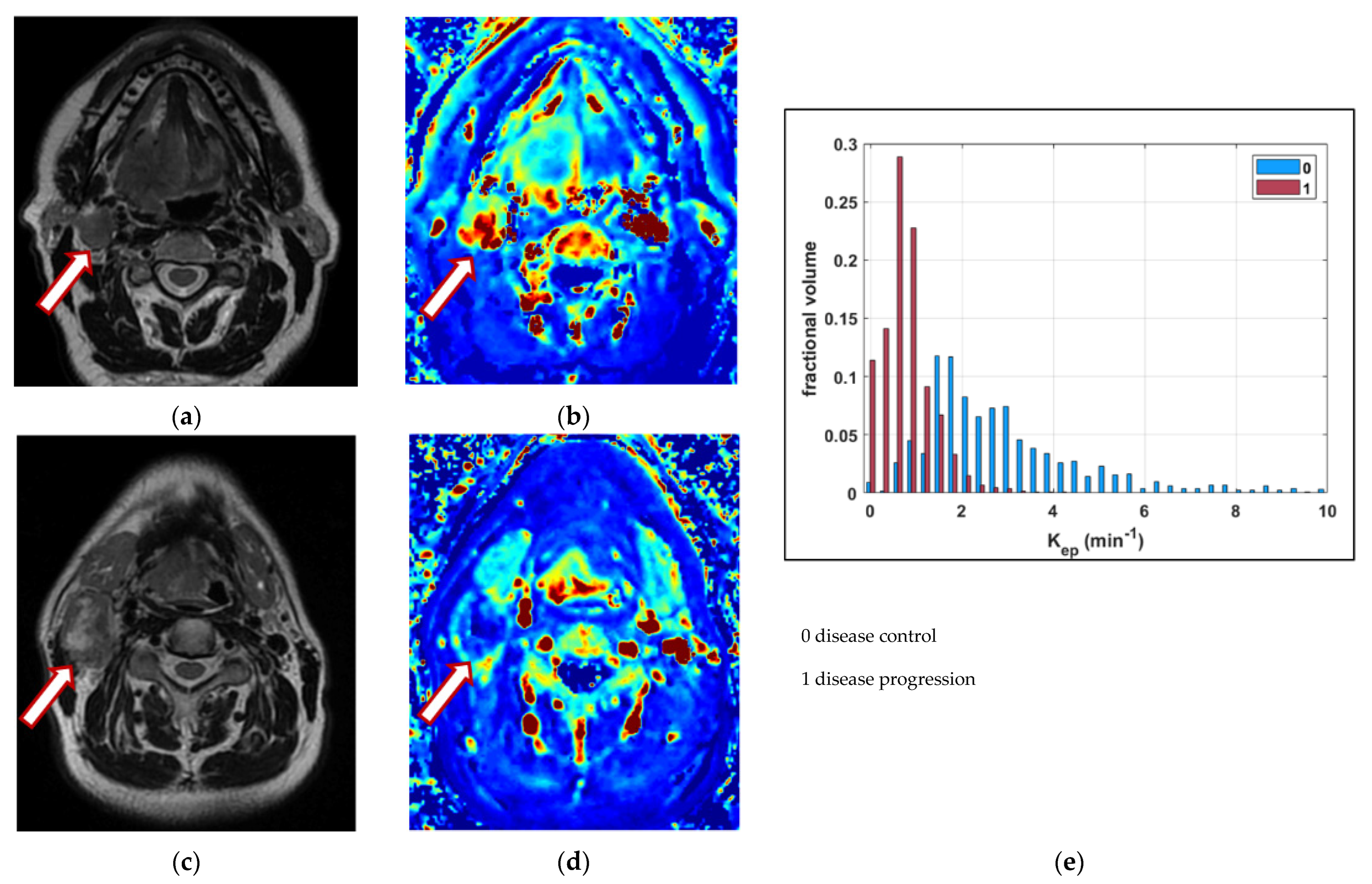 Cancers 14 02477 g001 Cancers 14 02477 g001