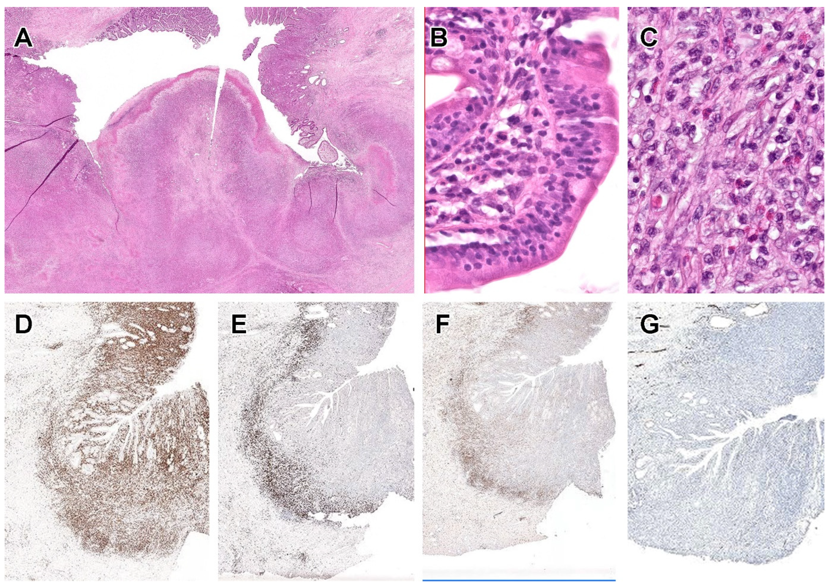 Cancers | Free Full-Text | Cellular Origins and Pathogenesis of 