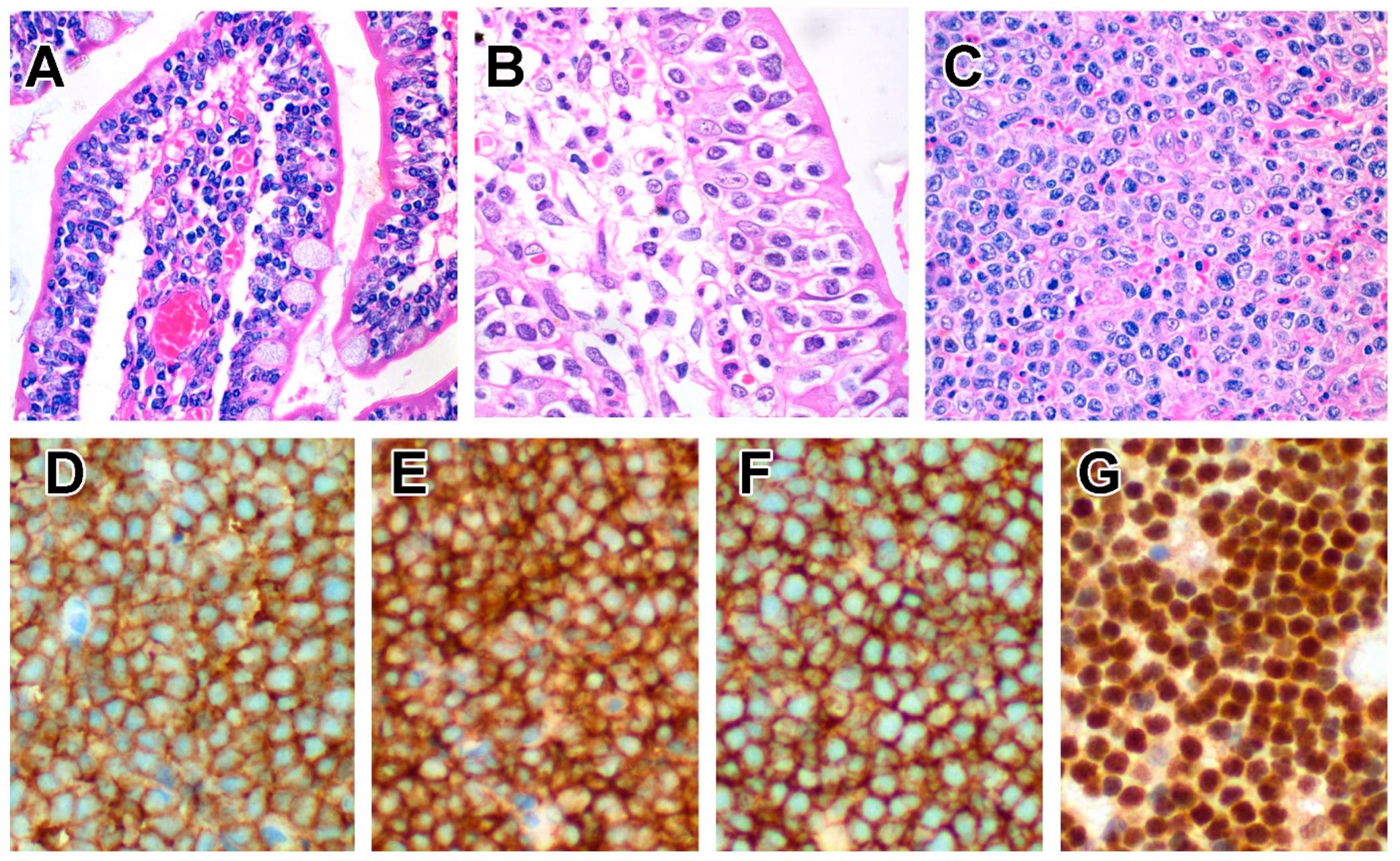 Cancers 14 02483 g004 Cancers 14 02483 g004