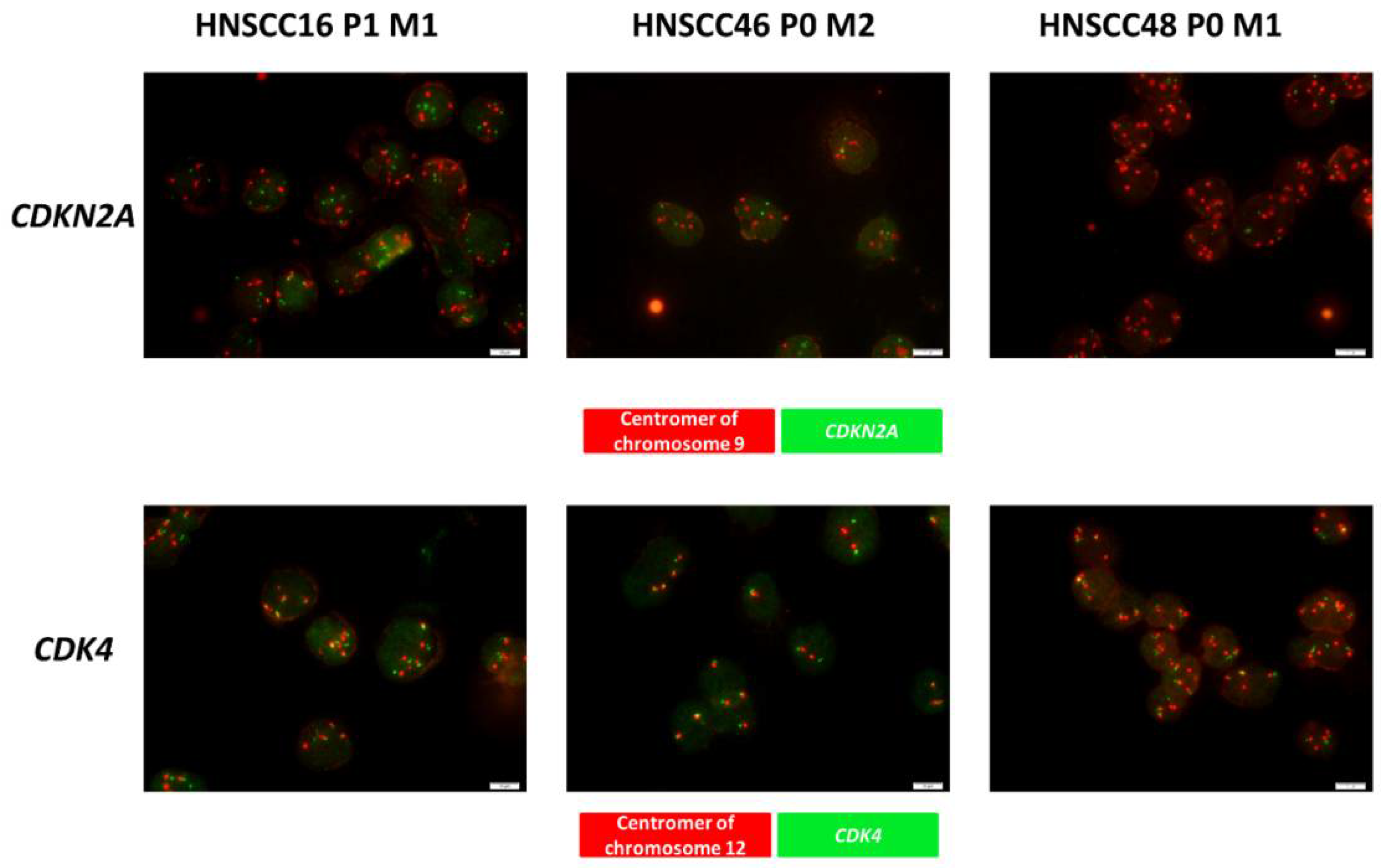 Cancers 14 02484 g002
