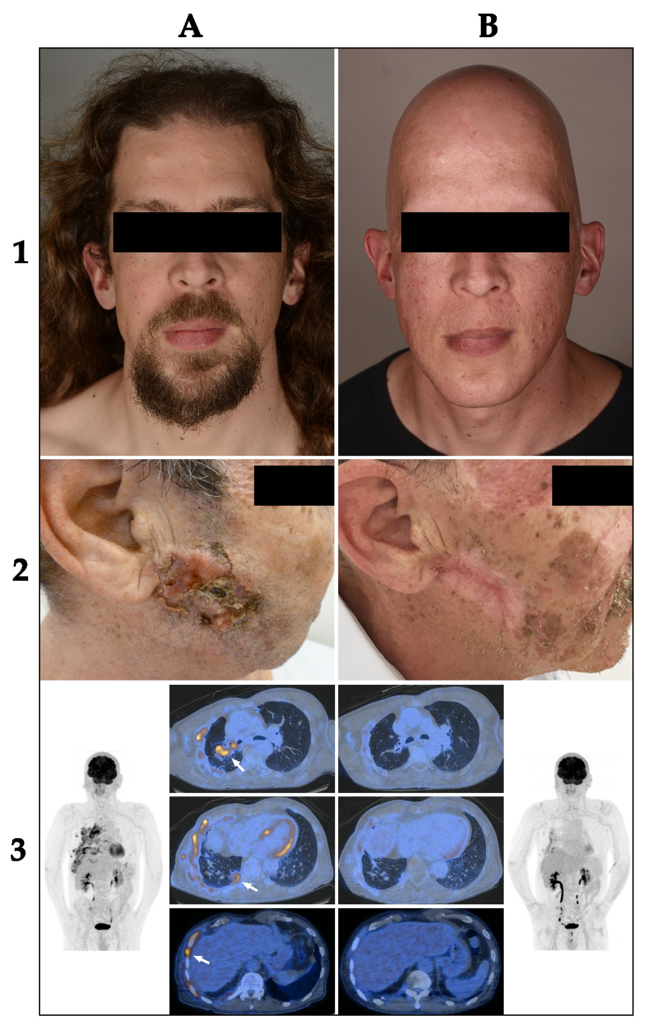 Cancers 14 02496 g003 550