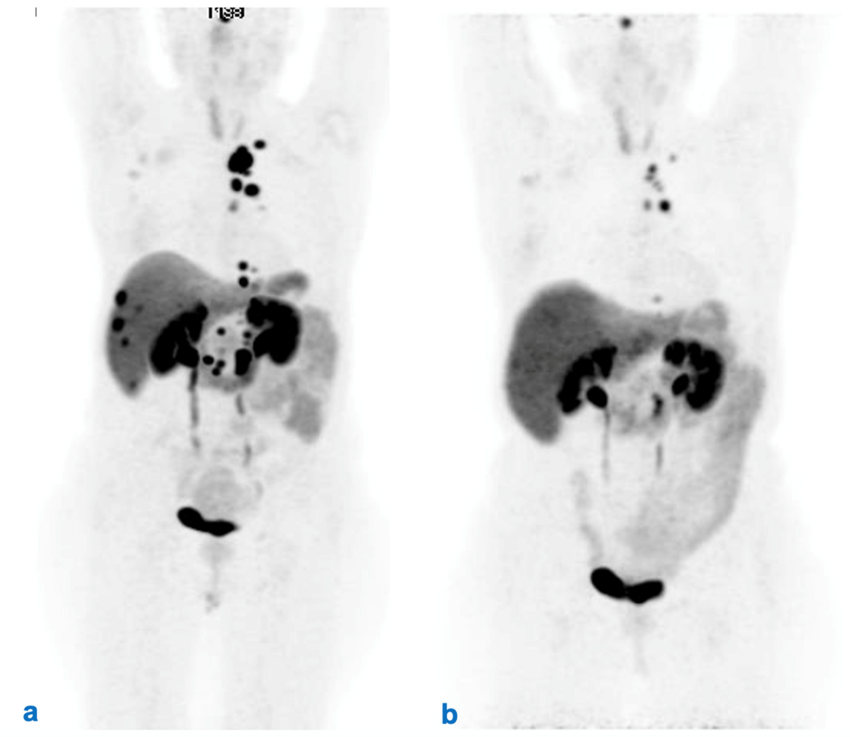 Cancers 14 02501 g003 550