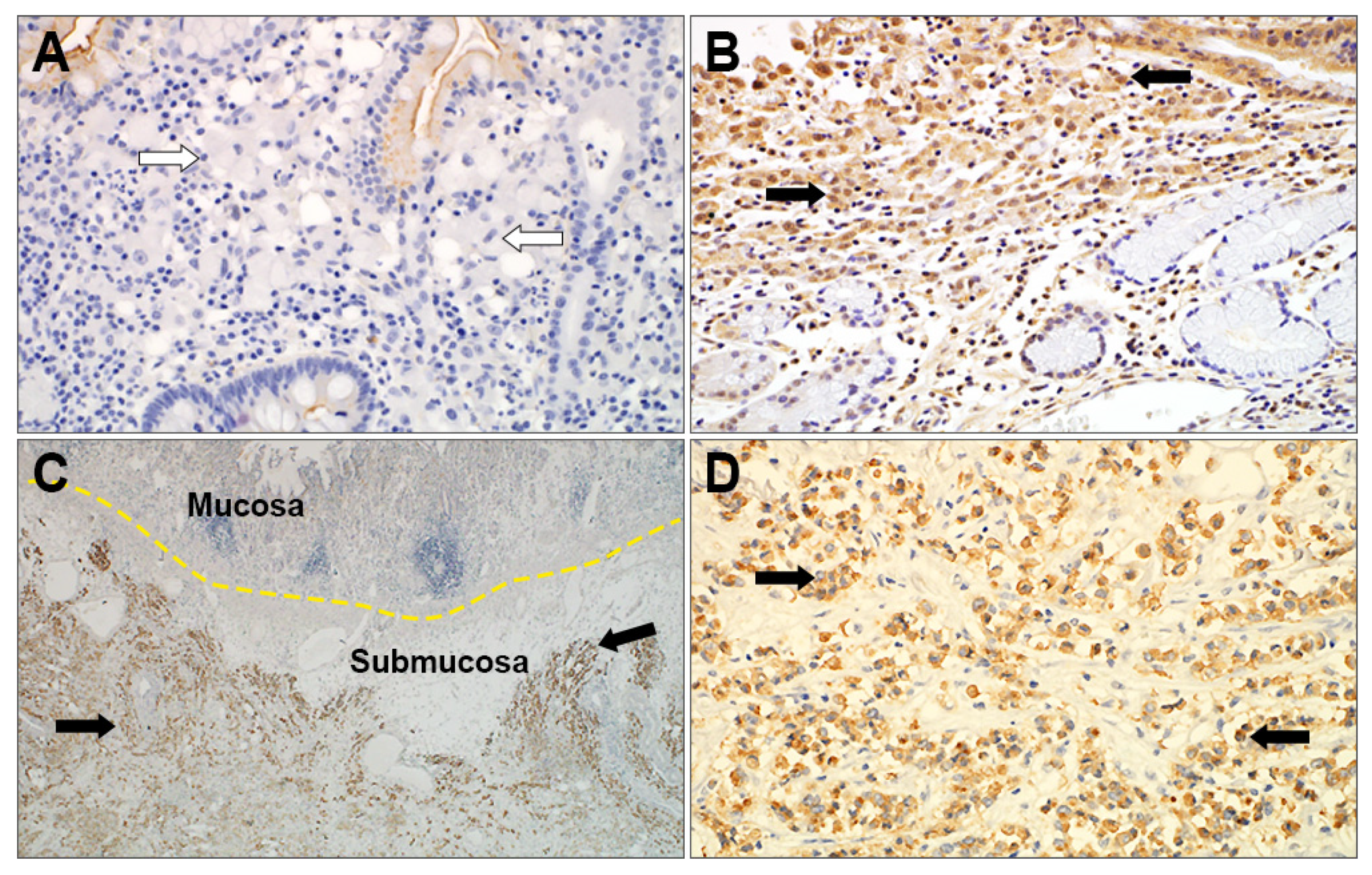 Cancers 14 02502 g004