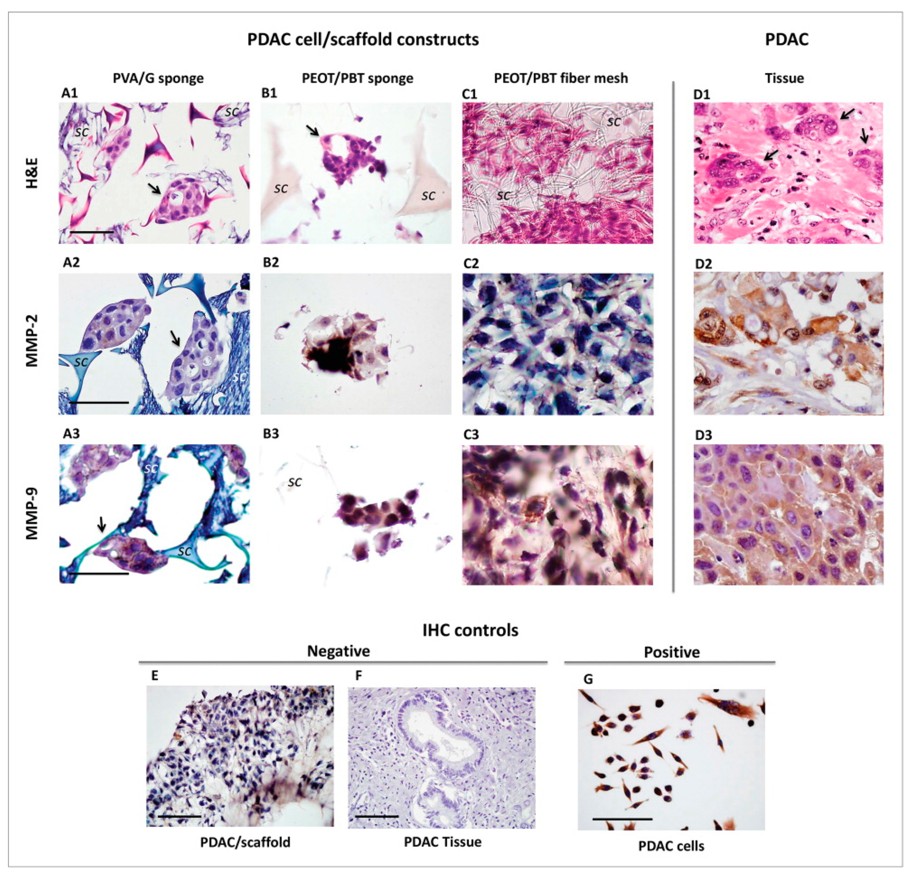 Cancers 14 02503 g002 550