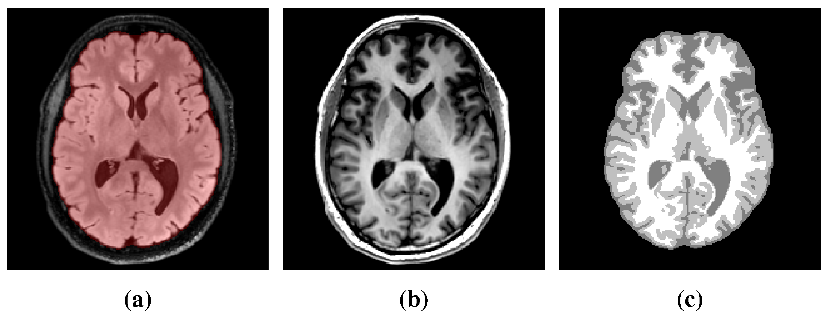 make stuff ブラック　ベスト Deep Learning for Reaction-Diffusion Glioma Growth Modeling