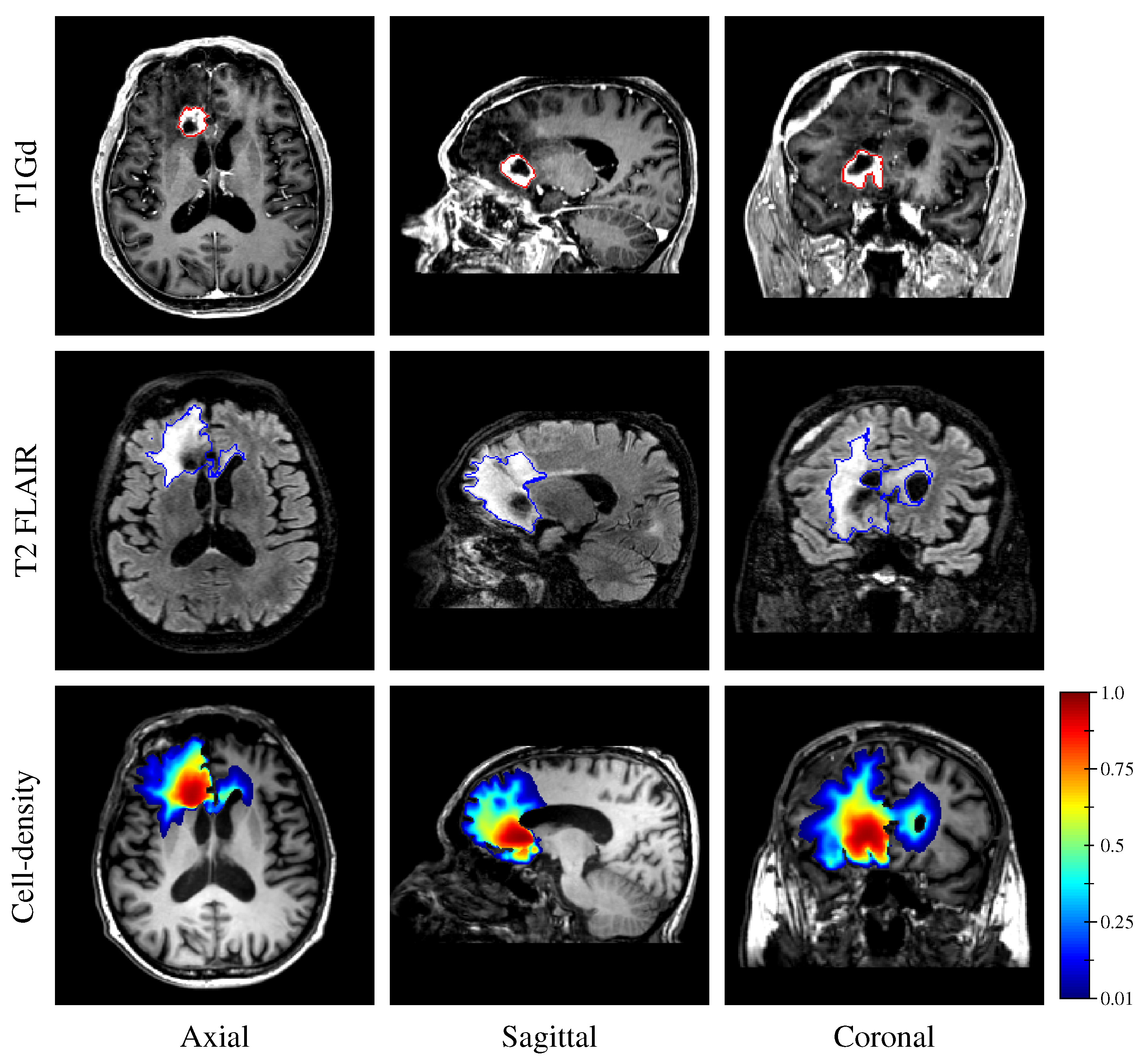 Cancers 14 02530 g012 550