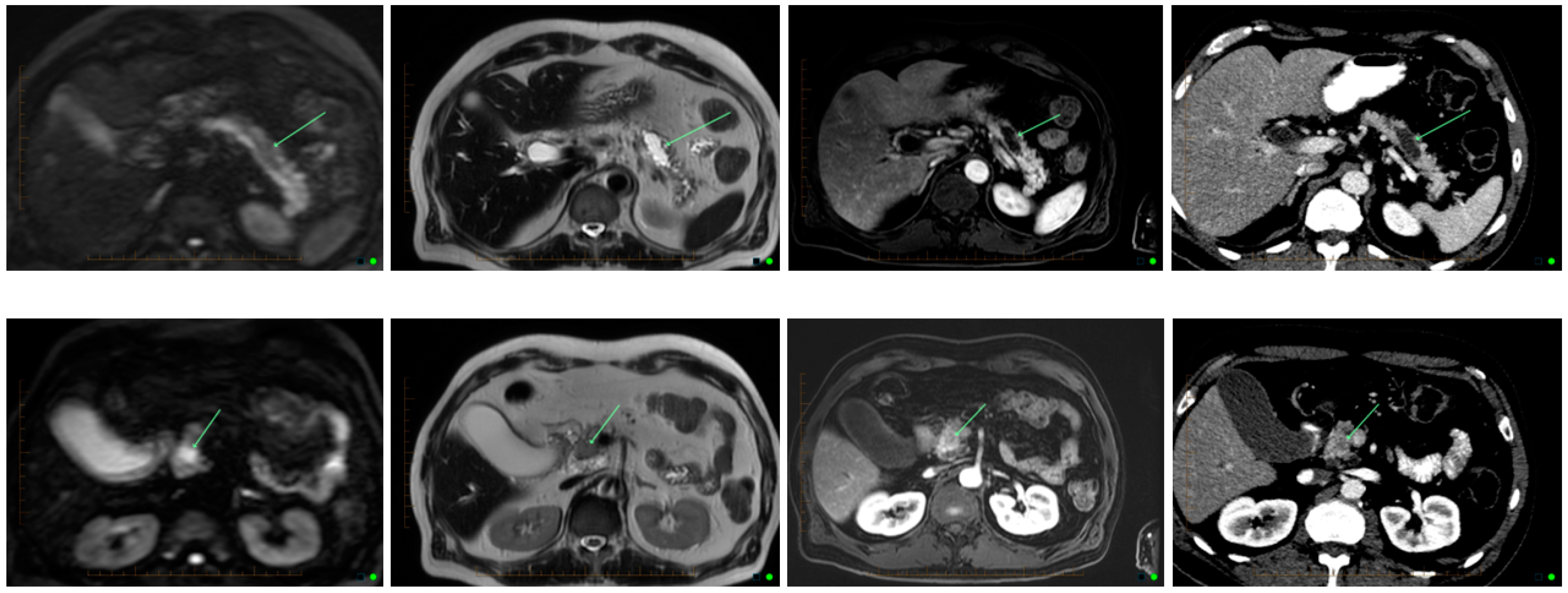 Cancers 14 02539 g001 550