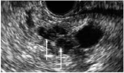 Cancers 14 02539 i002