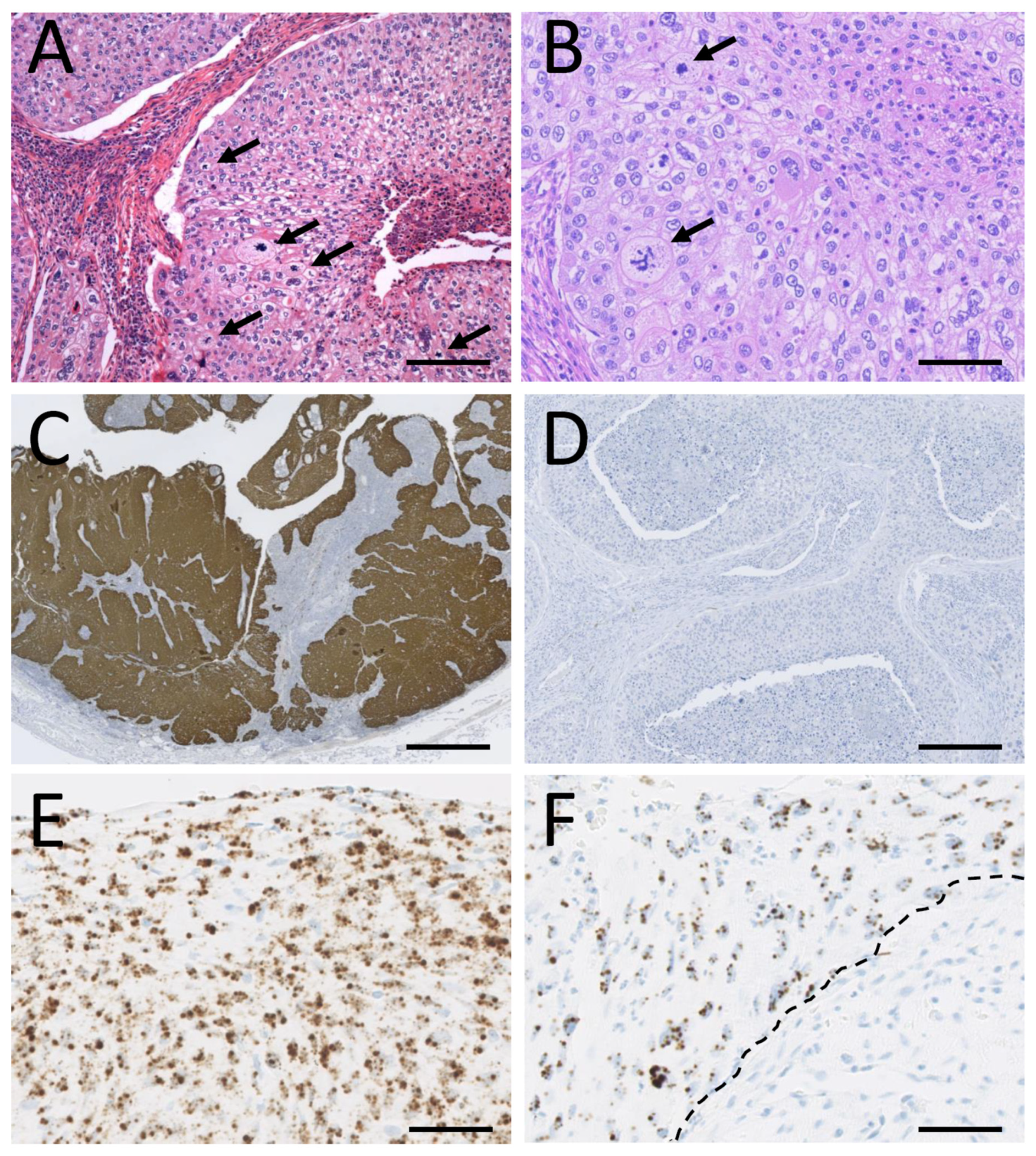 Cancers 14 02558 g003