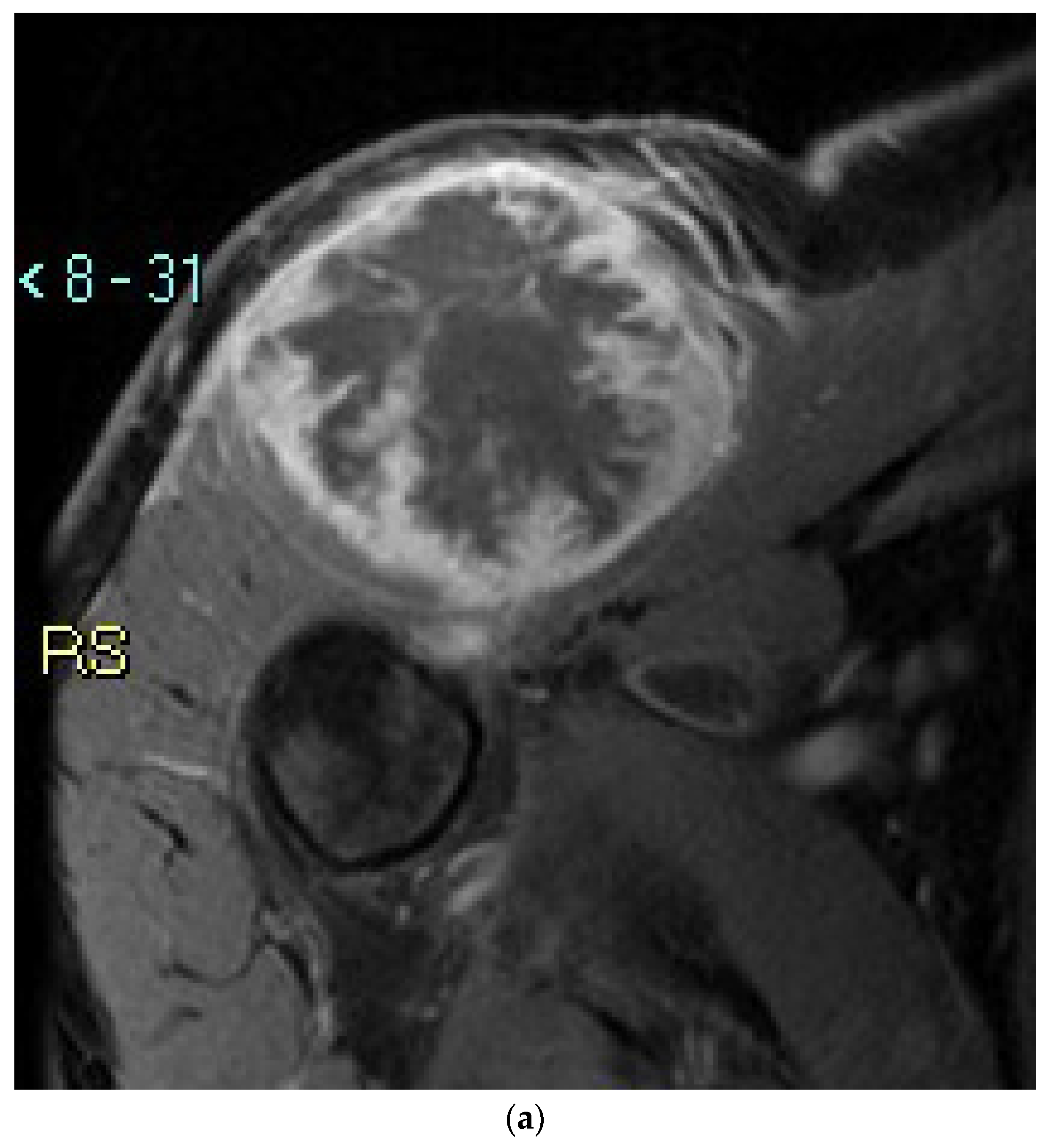 Cancers 14 02559 g001a