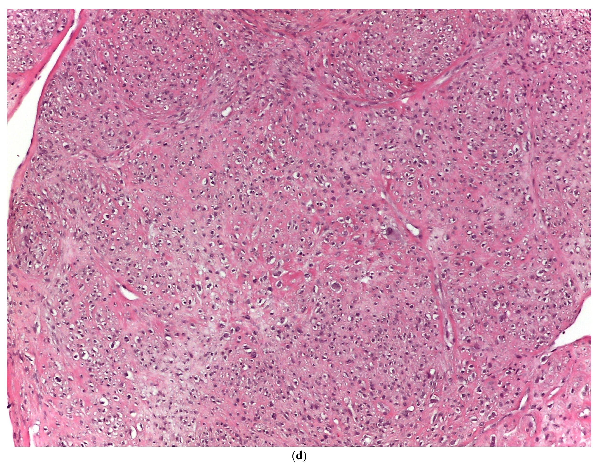 Cancers 14 02559 g001c