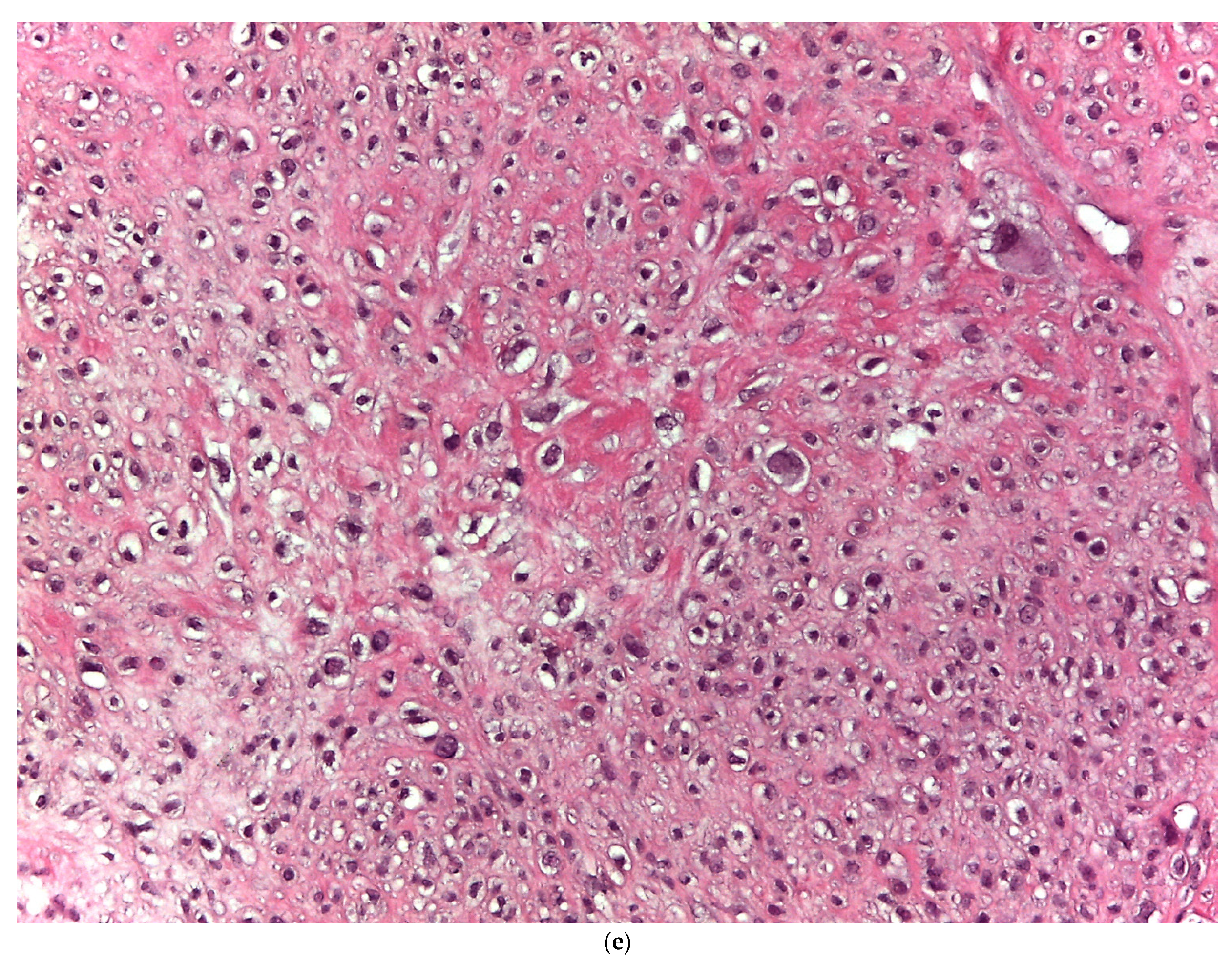 Cancers 14 02559 g001d