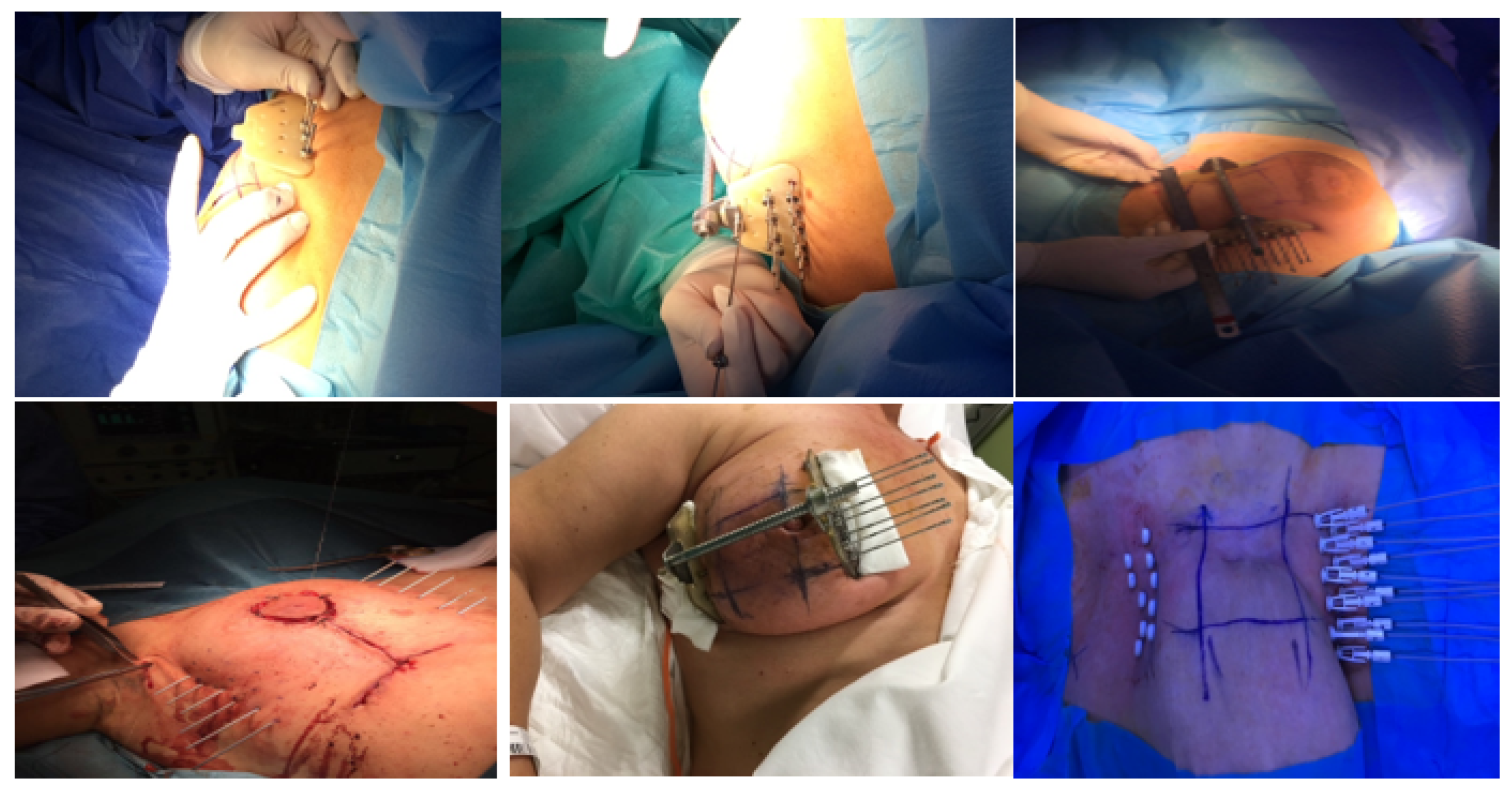 Cancers 14 02564 g001