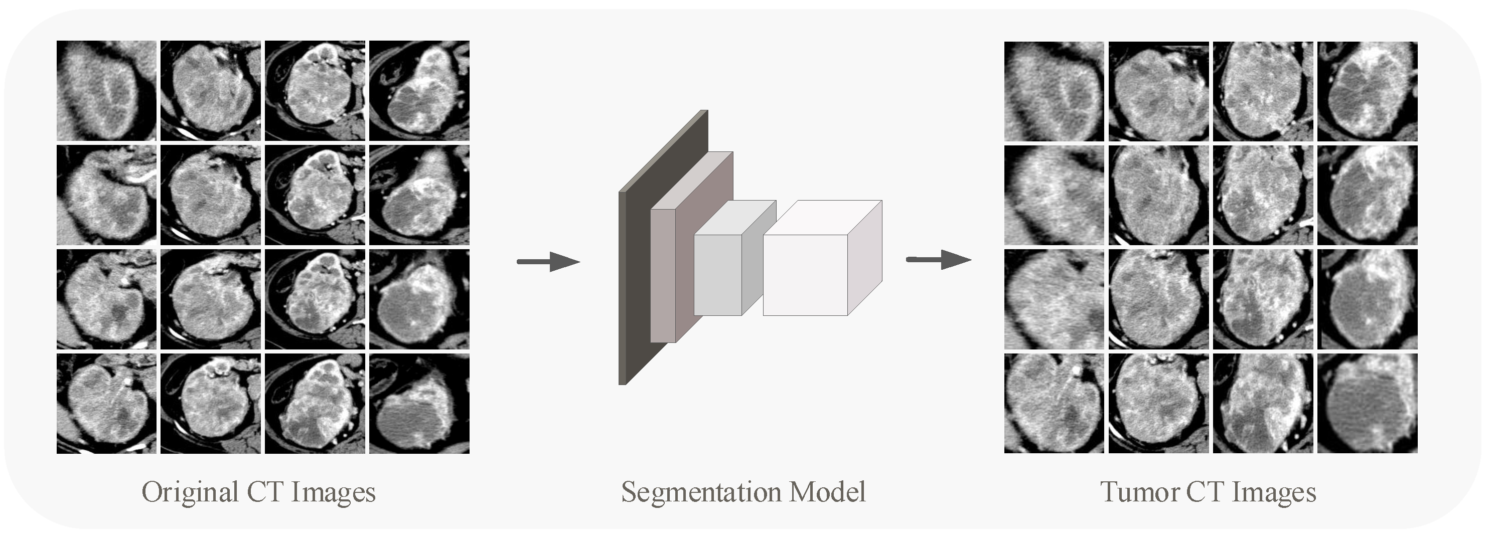 Cancers 14 02574 g001 550