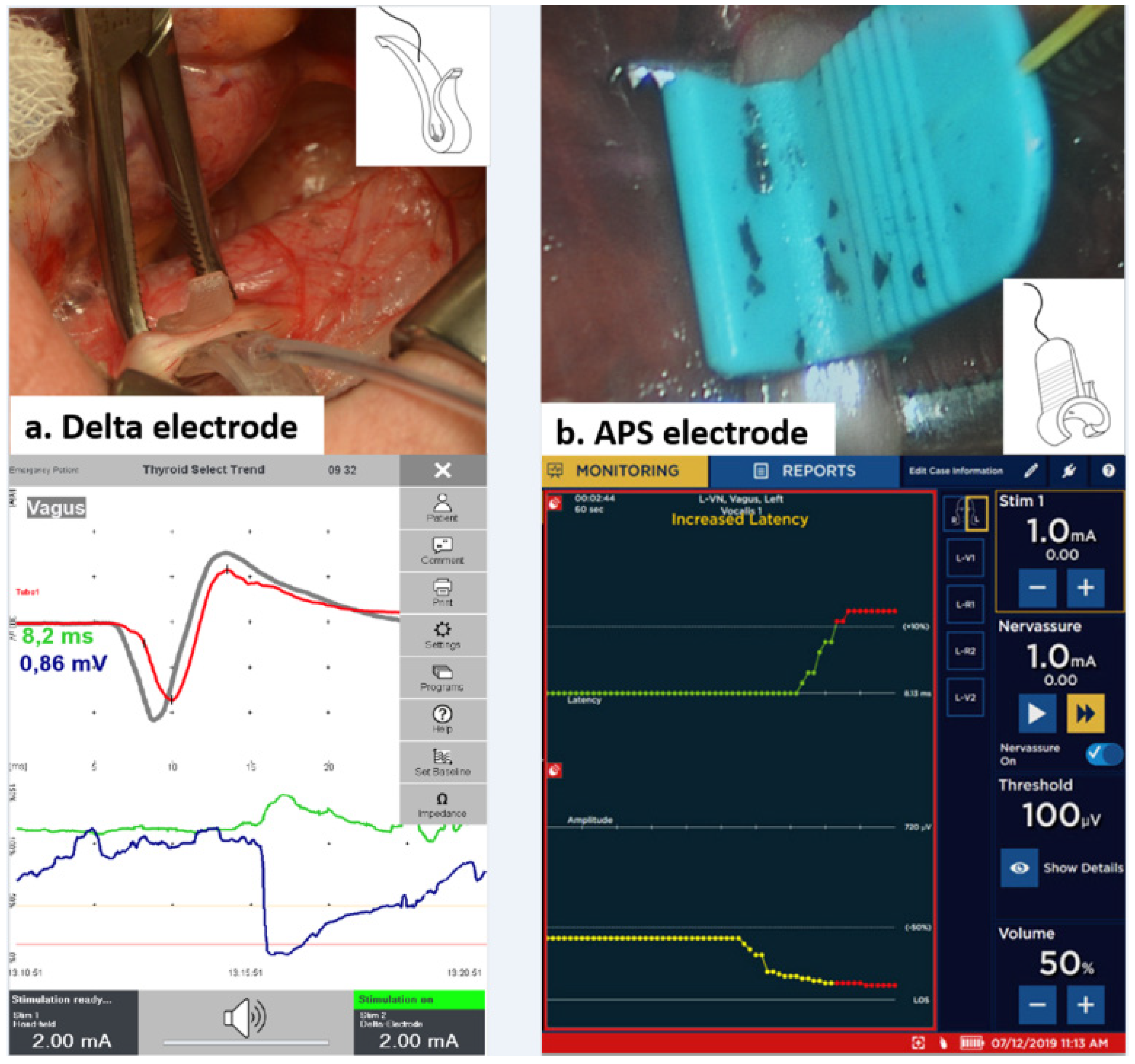 Cancers 14 02586 g001