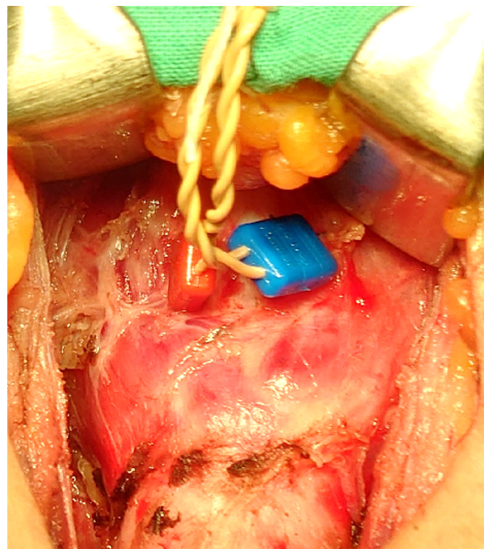 Cancers 14 02586 g003