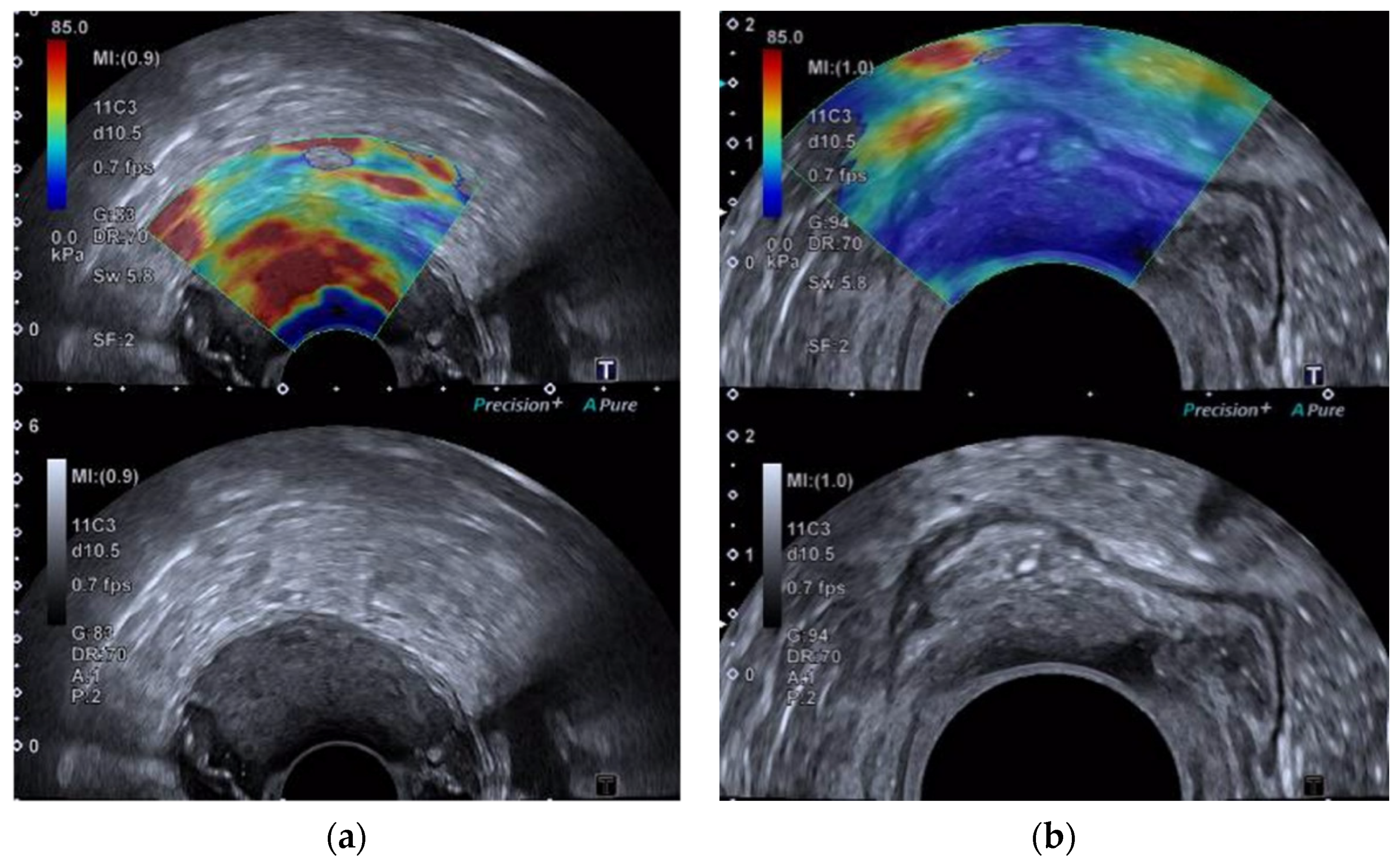 Cancers 14 02633 g001 550