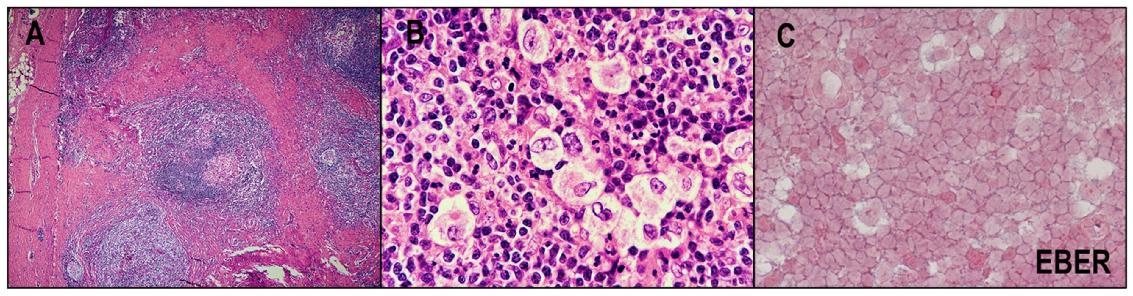 Cancers 14 02647 g002 Cancers 14 02647 g002