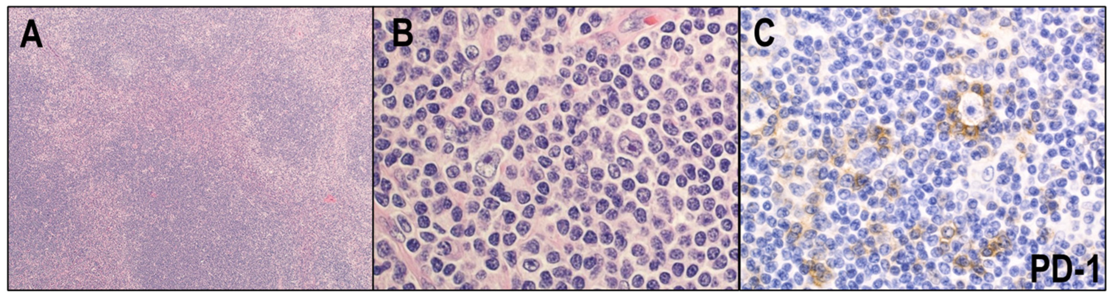 Cancers 14 02647 g004 Cancers 14 02647 g004