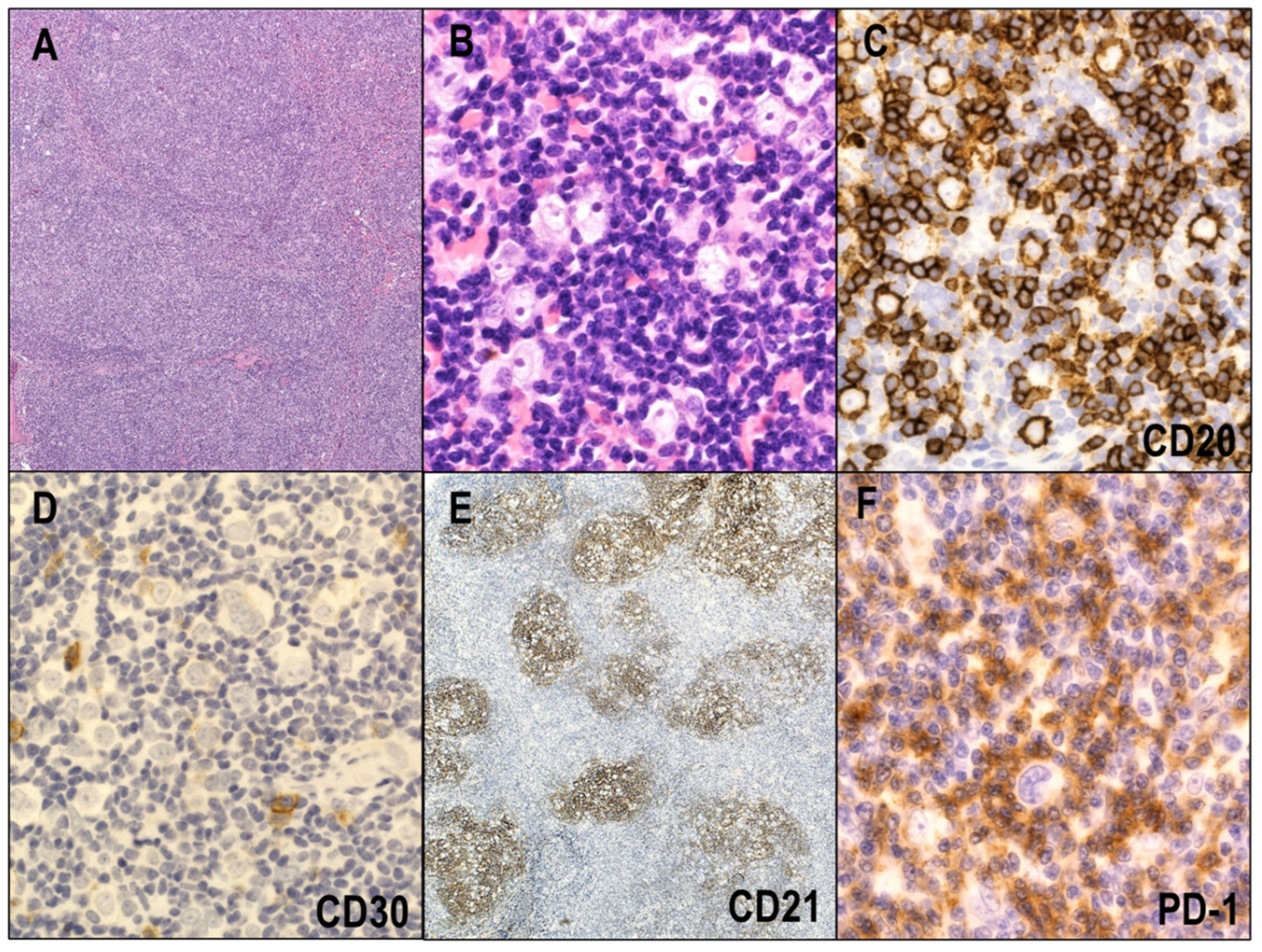 Cancers 14 02647 g006 Cancers 14 02647 g006