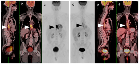 健康・医学 PET in Clinical Oncology PET Molecular Imaging: A Holistic Review of Current Practice