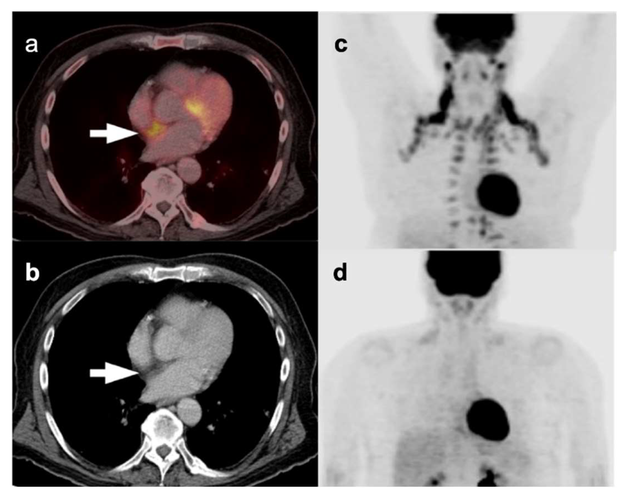 Frontiers  Specific imaging features indicate the clinical